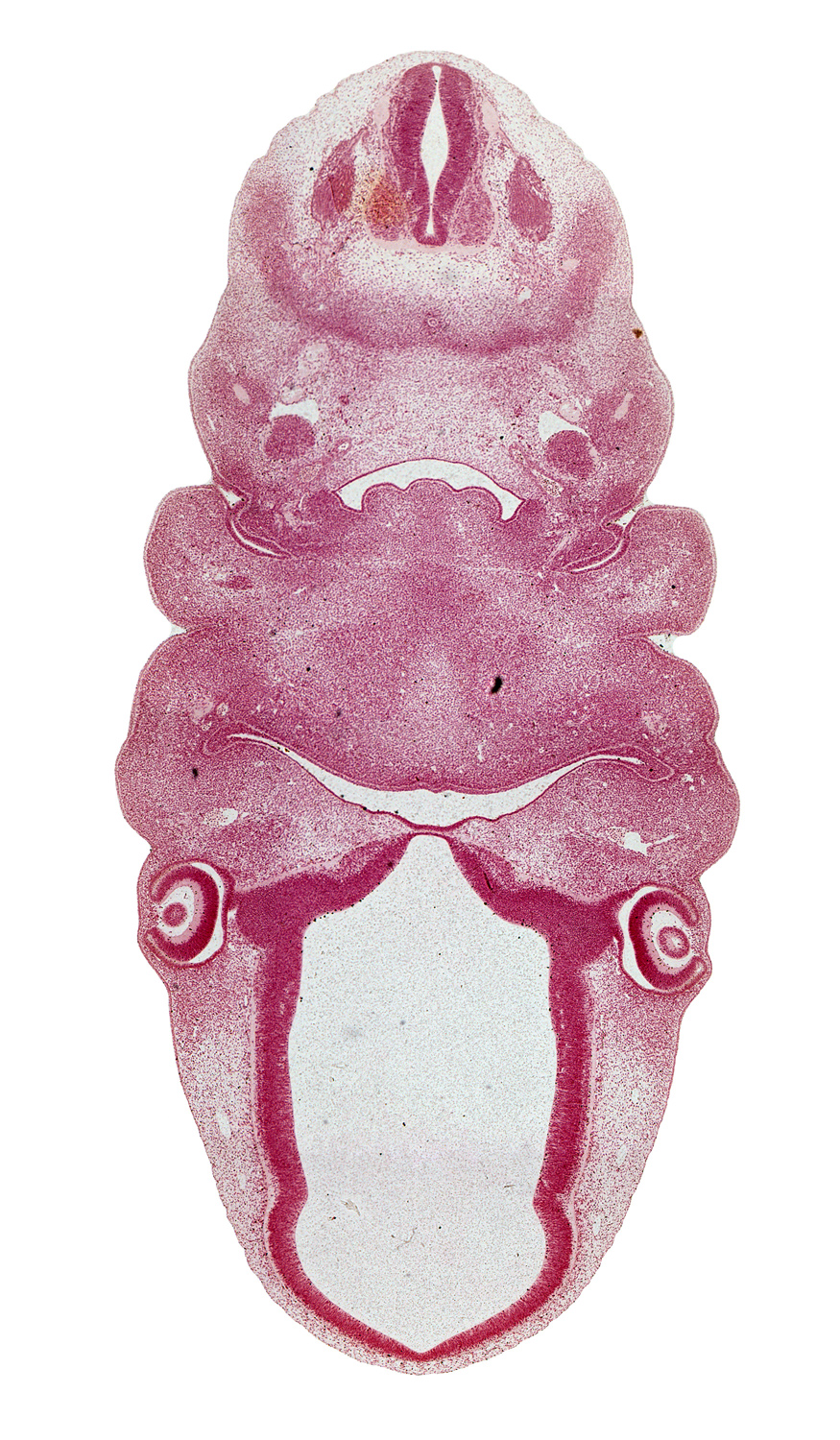 C-2 spinal ganglion, aortic arch 3, auricular hillock, caudal edge of pharyngeal pouch 2, closing membrane between pharyngeal groove 2 and pharyngeal pouch 2, dorsal fasciculus, epithalamus, hypoglossal nerve (CN XII), internal carotid artery, intraretinal space (optic vesicle cavity), lateral lingual swelling of tongue, lens vesicle, marginal ridge, optic chiasma (chiasmatic plate), optic cup cavity, optic groove, optic stalk (CN II), oronasal cavity, pharyngeal groove 1, premuscle mass of tongue, primordial meninx, surface ectoderm, sympathetic trunk, vertebral artery