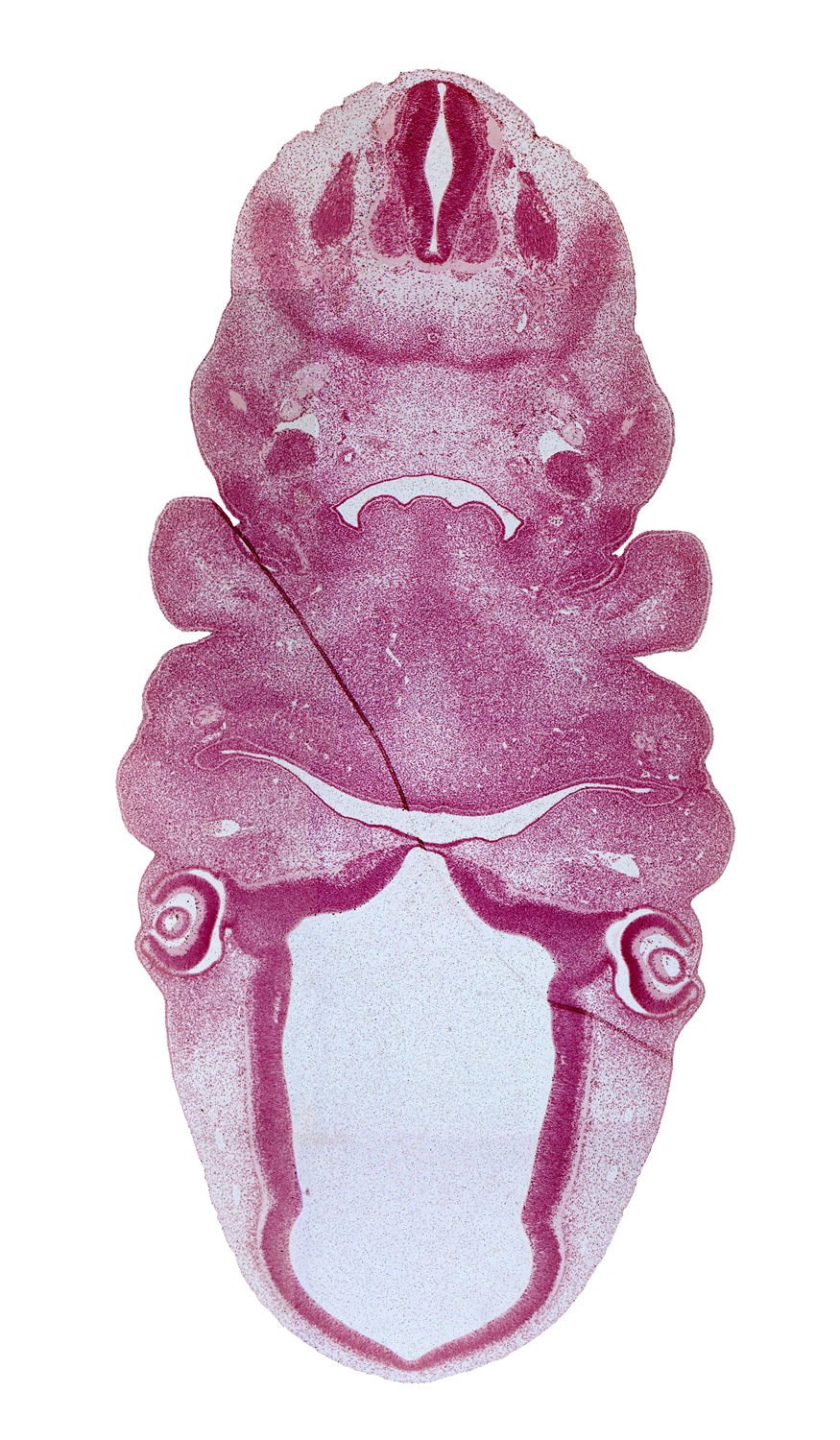 C-2 spinal ganglion, central canal, corneal epithelium, dorsal thalamus, edge of pineal bud, epithalamus, intermediate zone, intraretinal space (optic vesicle cavity), laryngeal pharynx, mandibular nerve (CN V₃), marginal ridge, marginal zone, maxillary vein, notochord, optic cup cavity, optic ventricle, oronasal cavity, pharyngeal arch 2, pharyngeal arch 3, pharyngeal groove 1, precardinal vein, premuscle mass of tongue, spinal accessory nerve (CN XI), third ventricle, ventral thalamus, ventricular zone