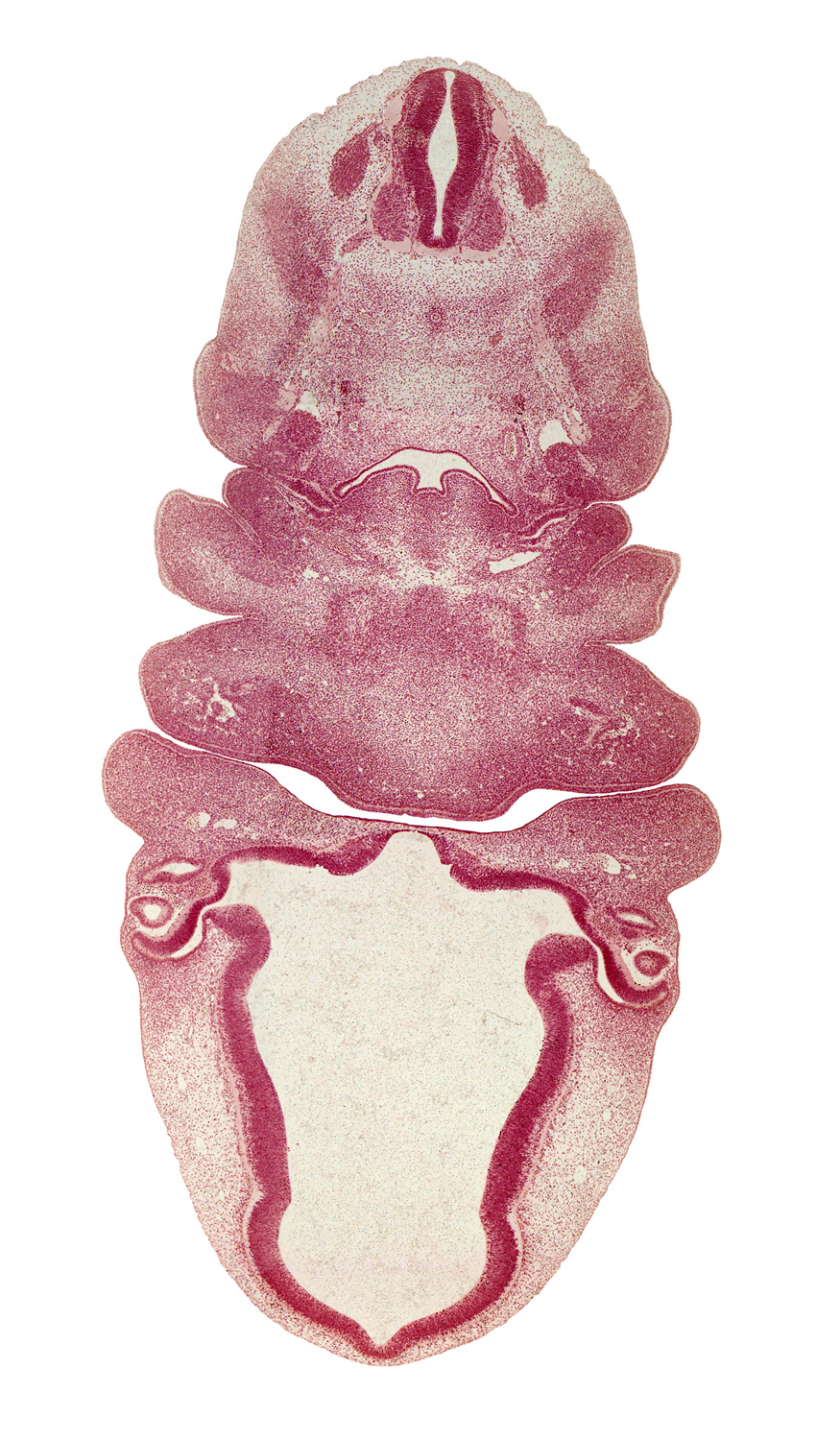 C-3 spinal ganglion, aortic arch 4, bilobed thyroid gland, central canal, epithalamus, head mesenchyme, inferior ganglion of vagus nerve (CN X), intraretinal space (optic vesicle cavity), junction of aortic arch 4 and carotid duct, laryngeal pharynx, lateral lingual swelling of tongue, maxillary prominence of pharyngeal arch 1, optic cup cavity, oral fissure, oronasal cavity, pharyngeal arch 1, pharyngeal arch 2, pharyngeal arch 4, pineal bud, precartilage condensation of pharyngeal arch 1 (Meckel), primordial meninx, sympathetic trunk, vascular plexus, ventral part of pharyngeal pouch 3 becomes thymus gland