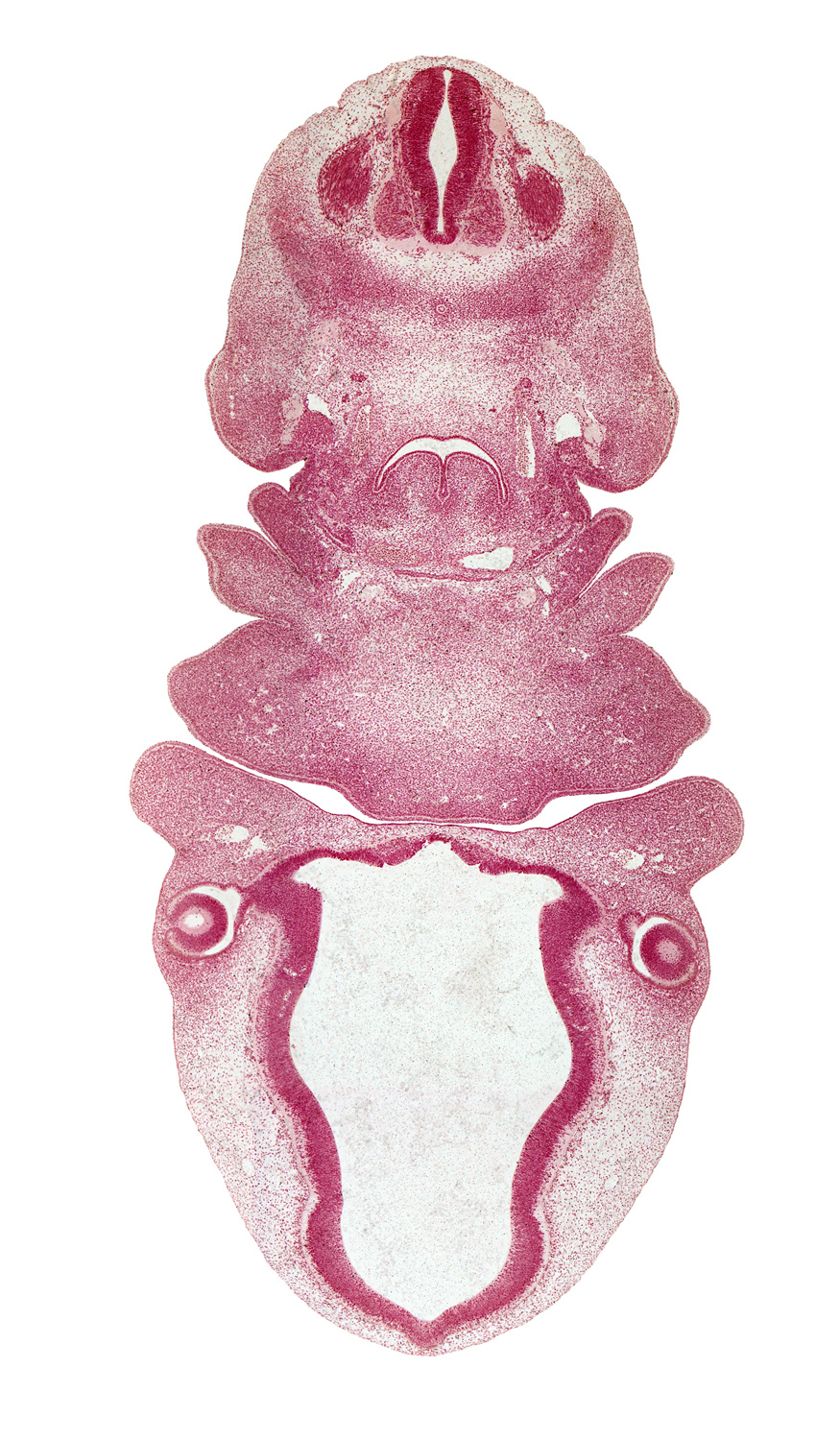 C-3 spinal ganglion, aortic arch 4, bilobed thyroid gland, caudal edge of pharyngeal arch 3, caudal edge of pharyngeal arch 4, cervical sinus, condensation around optic cup, dense caudal part of sclerotome, epithalamus, horn of aortic sac, intermediate zone, mandibular prominence of pharyngeal arch 1, marginal zone, maxillary prominence of pharyngeal arch 1, maxillary vein, medial eminence, oral fissure, oronasal cavity, pharyngeal arch 2, pineal bud, surface ectoderm, sympathetic trunk, ventricular zone