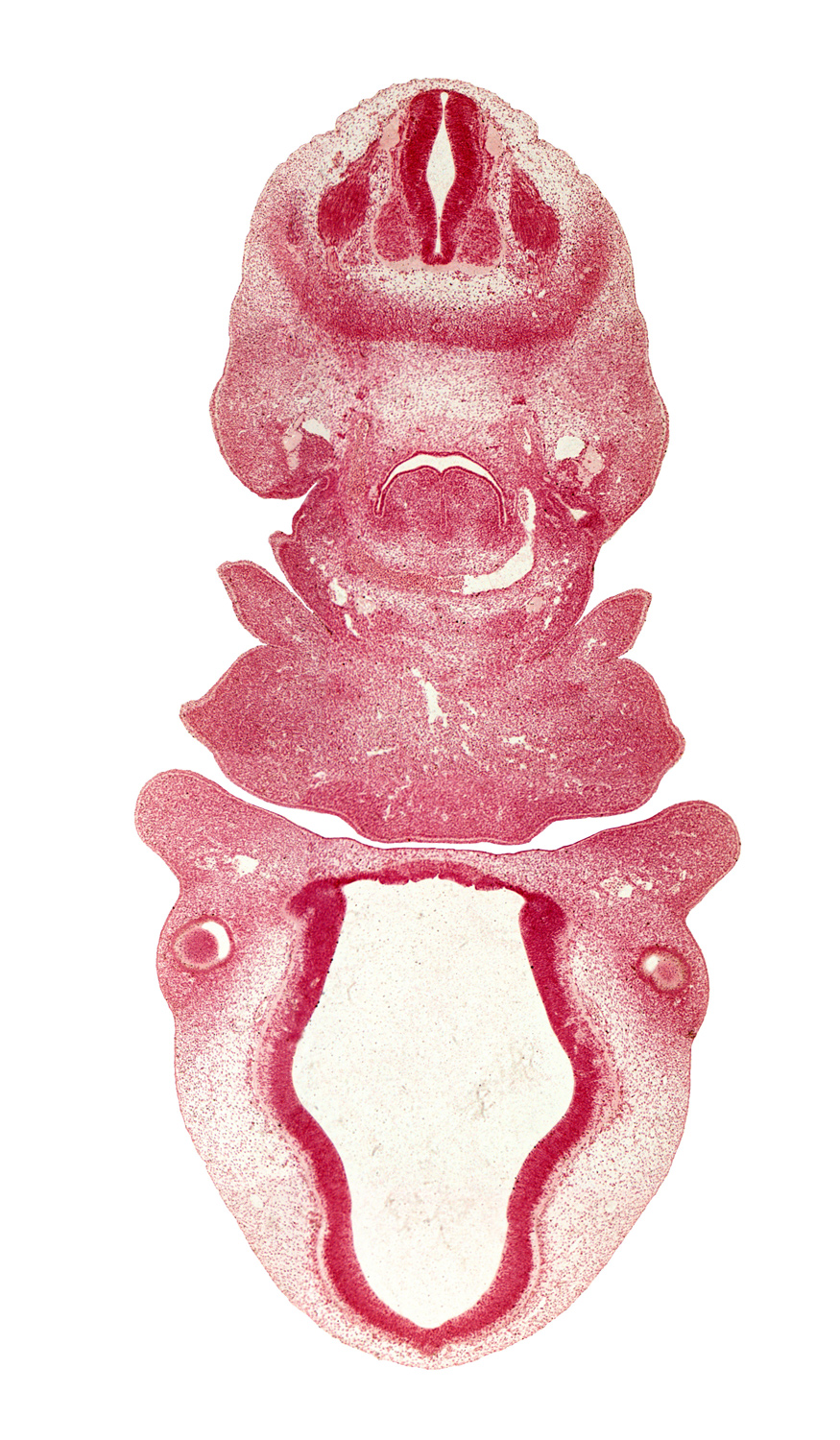 C-3 spinal ganglion, aortic sac, condensation around optic cup, dense caudal part of sclerotome, dorsal aorta, dorsal fasciculus, front part of tongue, head mesenchyme, hypoglossal nerve (CN XII), junction of aortic arches 4 and 6 and horn of aortic sac, laryngeal condensation, maxillary prominence of pharyngeal arch 1, maxillary vein, optic chiasma (chiasmatic plate), oral fissure, oronasal cavity, precardinal vein, surface ectoderm, sympathetic trunk, third ventricle, vagus nerve (CN X)