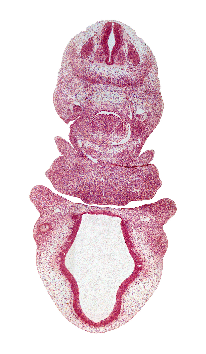 C-3 spinal ganglion, alar plate(s), aortic arch 6, aortic sac, basal plate, diencephalon, dorsal aorta, dorsal ramus, edge of cerebral vesicle (telencephalon), edge of lateral lingual swelling of tongue, edge of optic chiasma (chiasmatic plate), floor plate, laryngeal pharynx, mandibular prominence of pharyngeal arch 1, maxillary prominence of pharyngeal arch 1, maxillary venous plexus, nasomaxillary groove, pharyngeal arch 2, pharyngeal pouch 4, roof plate, sulcus limitans, third ventricle, transition region, transition region between telencephalon and diencephalon