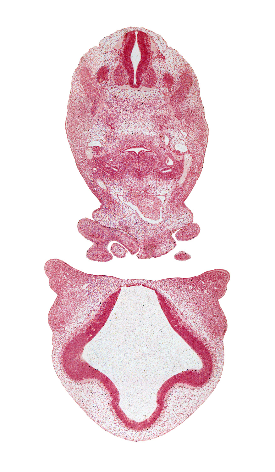 C-4 spinal ganglion, anterior cerebral artery, aortic arch 6, ascending aorta, dorsal aorta, edge of nasal sac epithelium, head mesenchyme, hypoglossal nerve (CN XII), interventricular foramen, junction of maxillary and medial nasal prominences, laryngeal pharynx, lateral ventricle, maxillary prominence of pharyngeal arch 1, medial nasal prominence(s), notochord, pharyngeal condensation, precardinal vein, primordial meninx, surface ectoderm, sympathetic trunk, third ventricle, torus hemisphericus, ultimopharyngeal pouch, vagus nerve (CN X), wall of truncus arteriosus (distal outflow tract)