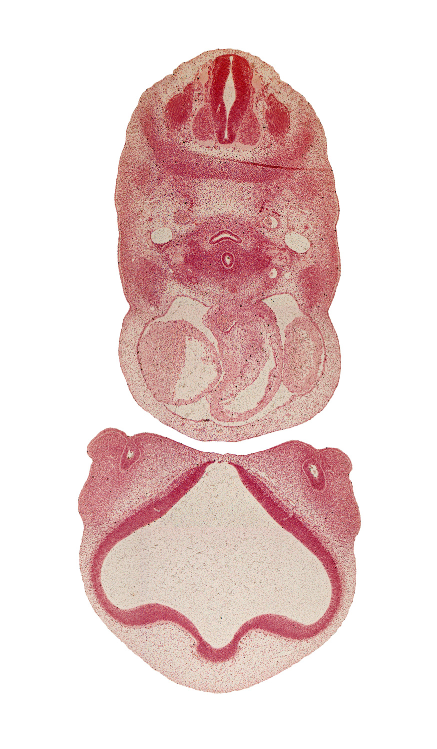 C-4 spinal ganglion, aortic arch 6, aorticopulmonary septum, ascending aorta, conus cordis (proximal outflow tract), dense caudal part of sclerotome, dorsal aorta, dorsal fasciculus, esophagus, intermaxillary segment, intermediate zone, interventricular foramen, lamina terminalis, lumen of nasal sac, marginal zone, maxillary prominence of pharyngeal arch 1, myotome, olfactory area, precardinal vein, pulmonary trunk, striatal part of cerebral vesicle (telencephalon), suprastriatal part of cerebral vesicle (telencephalon), torus hemisphericus, trachea, undivided truncus arteriosus, ventricular zone