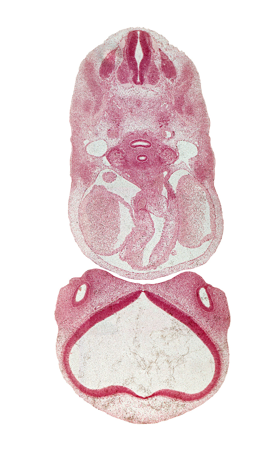 C-4 spinal ganglion, ascending aorta, central canal, dermatome, dorsal aorta, dorsal ramus of C-4 spinal nerve, edge of sinus venosus, infrahyoid premuscle mass, lateral nasal prominence, lateral ventricle, left atrial wall, lumen of nasal sac, myotome, origin of aortic arch 6 from truncus arteriosus, paraphysial arch, precardinal vein, pulmonary trunk, striatal part of cerebral vesicle (telencephalon), suprastriatal part of cerebral vesicle (telencephalon), sympathetic trunk, third ventricle, undivided conus cordis, undivided truncus arteriosus, vagus nerve (CN X), ventral ramus of C-4 spinal nerve