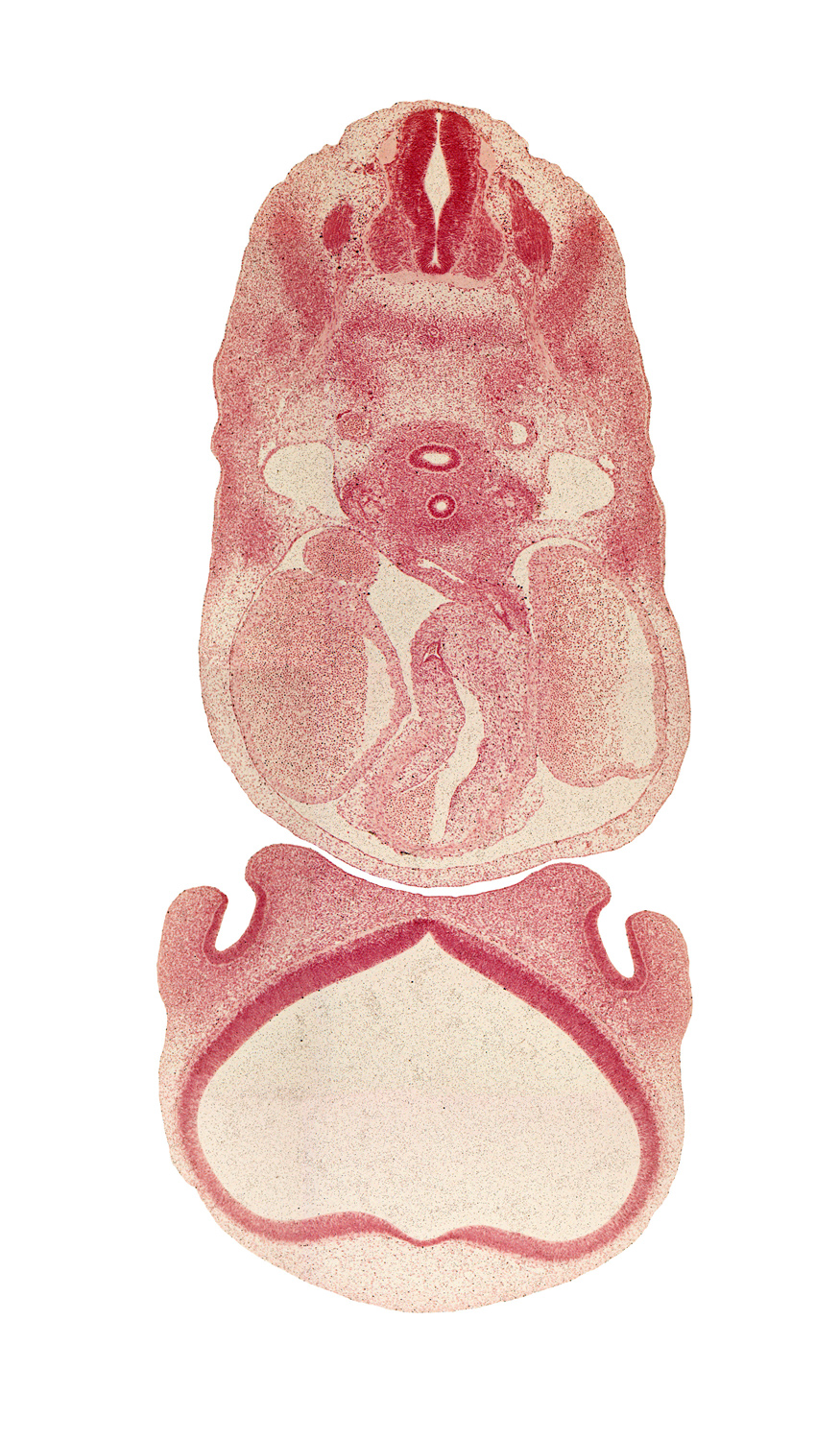 C-4 spinal ganglion, C-4 spinal nerve, aorticopulmonary septum, ascending aorta, central canal, cerebral vesicle (telencephalon), conus cordis, dermatome, head mesenchyme, interventricular foramen, lateral nasal prominence, left atrium, medial nasal prominence(s), myotome, nasal septum region, notochord, olfactory area, precardinal vein, pulmonary trunk, right atrium, right pulmonary artery, sclerotome, truncus arteriosus