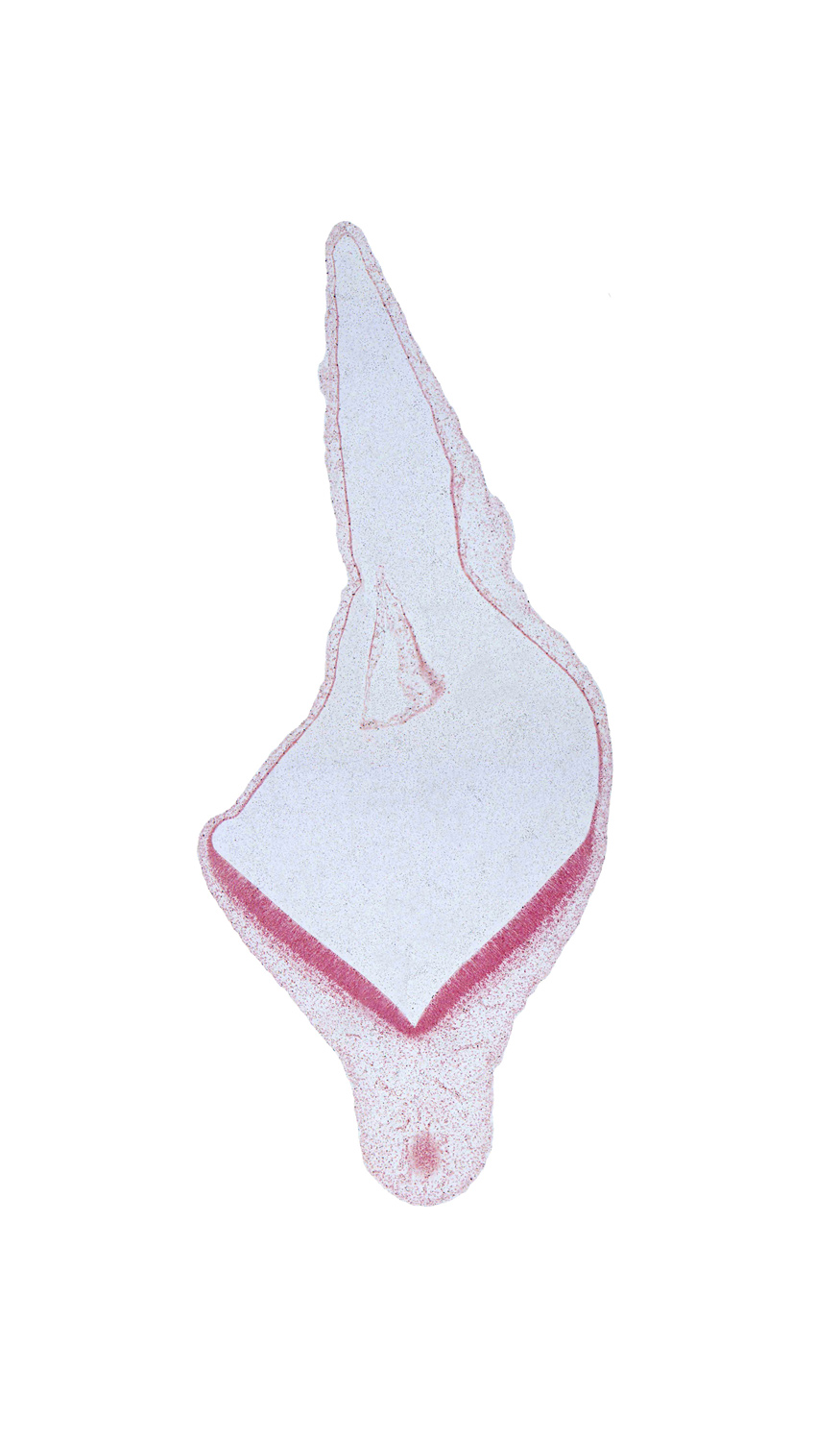 edge of mesencephalon, external space, head mesenchyme, rhombencoel (fourth ventricle), roof plate, surface ectoderm