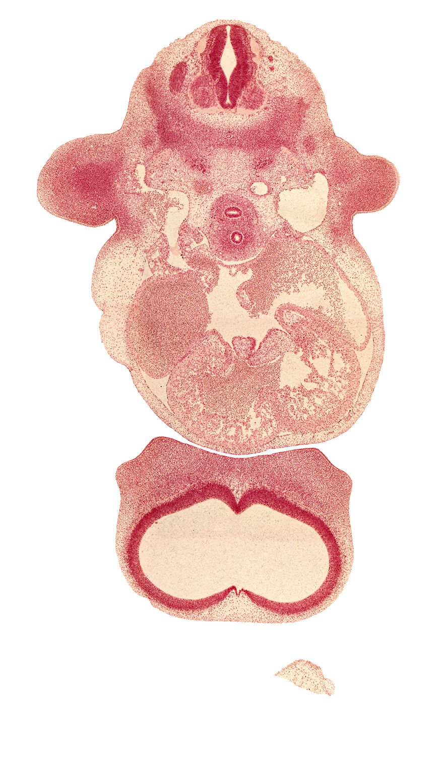 C-5 / C-6 interganglion region, axial artery, cerebral vesicle (telencephalon), cervical plexus, common cardinal vein, dorsal aorta, dorsal atrioventricular endocardial cushion, fusion point of atrioventricular endocardial cushions, head mesenchyme, interventricular foramen, junction of common cardinal vein and right sinus horn, junction of lateral and medial nasal prominences, junction of postcardinal and precardinal veins, lateral atrioventricular endocardial cushion, lateral ventricle, left atrioventricular canal, neural arch, phrenic nerve, primary interatrial foramen (foramen primum), primary interatrial septum (septum primum), right and left valves of sinus venosus, right atrioventricular canal, secondary interatrial septum (septum secundum), skeletal blastema of humerus, sympathetic trunk, ventral atrioventricular endocardial cushion