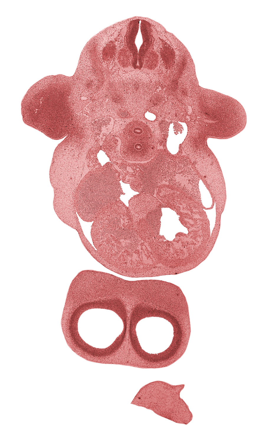 C-6 spinal ganglion, C-6 ventral primary ramus, C-6 ventral root, atrioventricular sulcus, central canal, cerebral vesicle (telencephalon), dorsal aorta, frontal prominence, fused atrioventricular endocardial cushions, head mesenchyme, interventricular foramen, interventricular sulcus, left atrioventricular canal, left atrium, left common cardinal vein, left ventricle, postcardinal vein, right atrioventricular canal, right atrium, sinu-atrial foramen, sinus venosus, sympathetic trunk, tuberculum olfactorium, upper limb