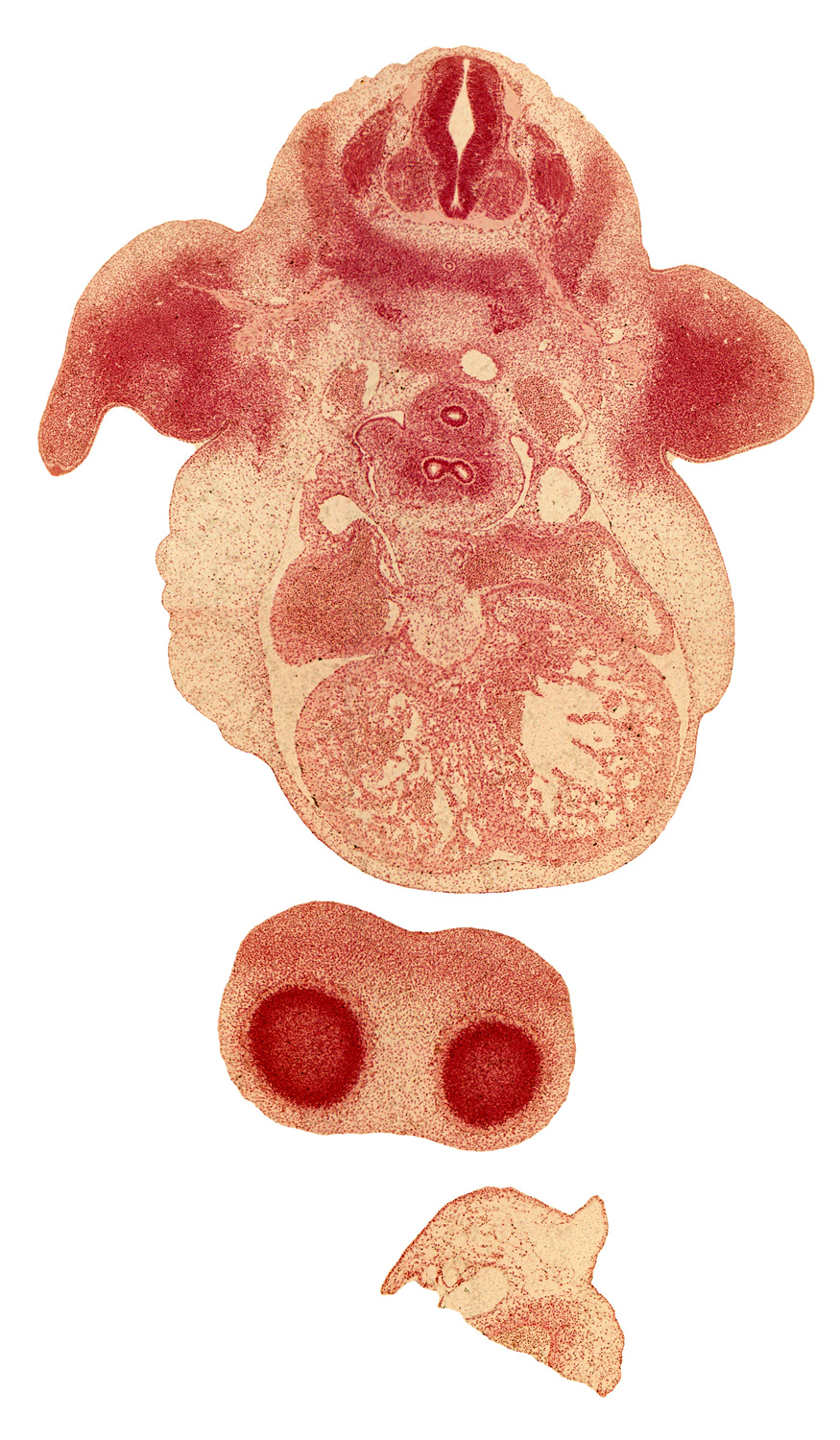 C-6 spinal ganglion, C-6 spinal nerve, apical epidermal ridge, arm region of upper limb, common pulmonary vein, dorsal fasciculus, edge of lateral ventricle, forearm region, frontal prominence, fused atrioventricular endocardial cushions, hand plate of upper limb, left atrium, left common cardinal vein, left ventricle, phrenic nerve, pleuropericardial fold, postcardinal vein, right and left venous valves, right ventricle, sinus venosus, sympathetic trunk, tracheal bifurcation