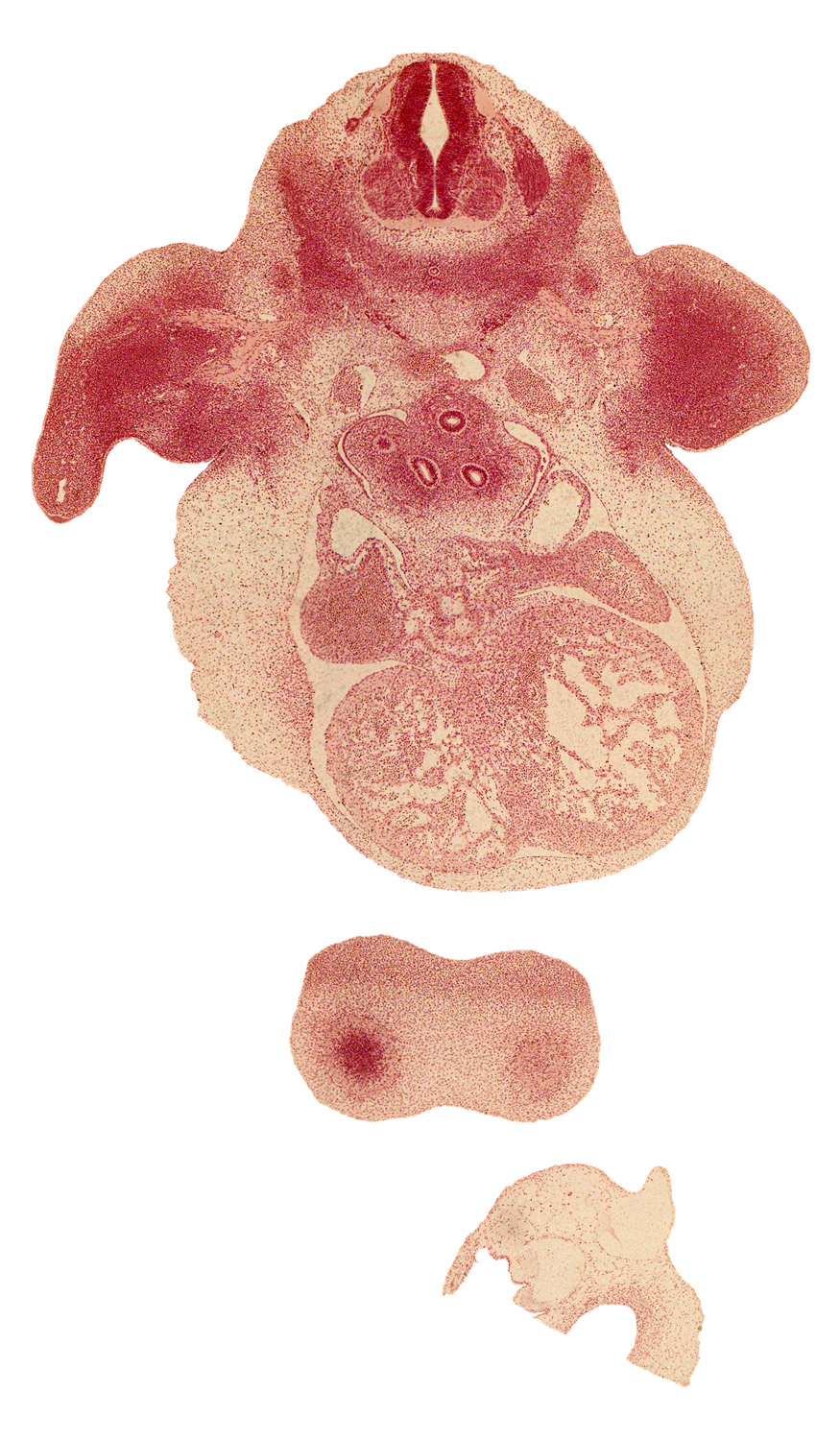 C-6 spinal ganglion, anterior spinal artery, cerebral vesicle (telencephalon), common pulmonary vein, edge of upper secondary bronchus bud, esophagus, frontal prominence, hand plate, heart prominence, left atrium, left common cardinal vein, left lung sac, marginal zone, pleuropericardial membrane, postcardinal vein, right atrium, right lung sac, sinus venosus, sympathetic trunk, trabecular part of left ventricle, ventricular zone