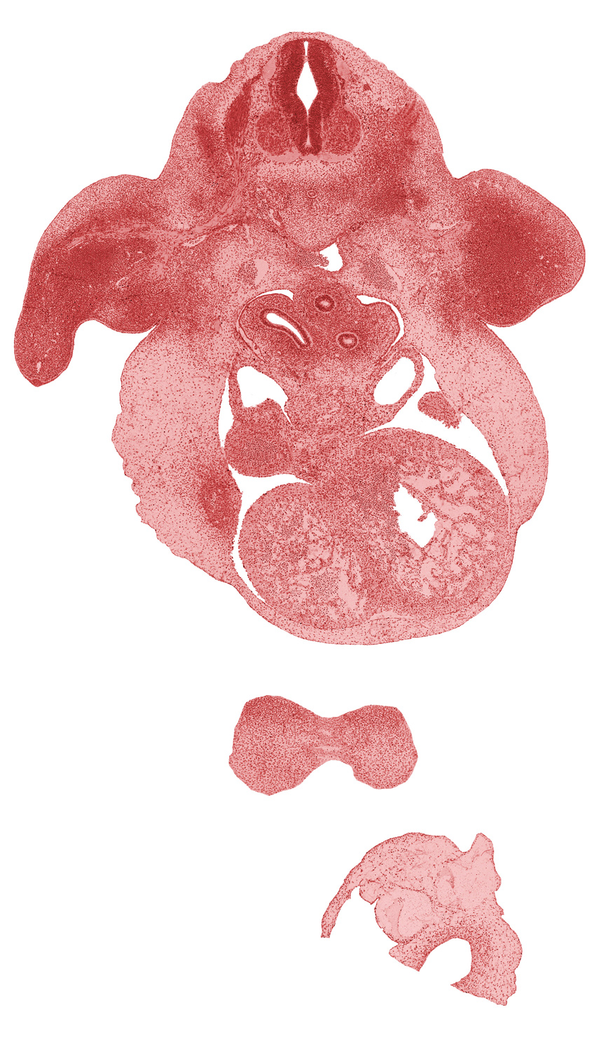 aorta, brachial plexus, caudal edge of left atrium, cephalic edge of liver, dorsal intersegmental artery, esophagus, frontal prominence, interventricular sulcus, left lung sac, left primary bronchus, pericardial cavity, right atrium, right lung sac, septum transversum, sinus venosus, subclavian artery, trabecular part of right ventricle, upper limb mesenchyme, upper secondary bronchus bud