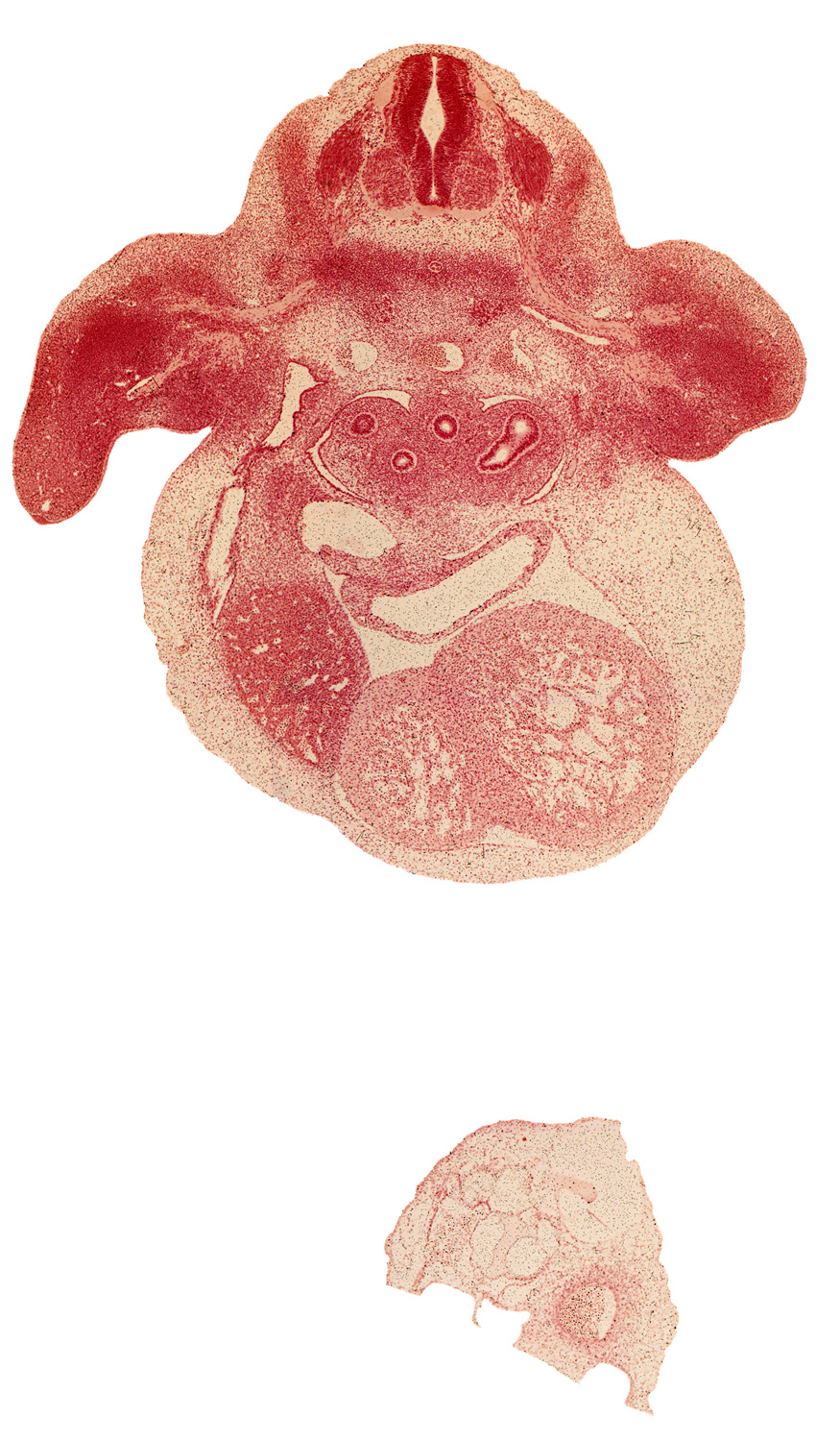 C-7 spinal ganglion, C-7 ventral primary ramus, aorta, brachial artery, edge of upper secondary bronchus bud, hand plate, heart prominence, interventricular sulcus, left horn of sinus venosus, median nerve, pleuropericardial membrane, primary bronchus, primordial meninx, primordial pleural cavity, pulmogenic coat, radial nerve, right lobe of liver, septum transversum, subclavian artery, upper secondary bronchus bud