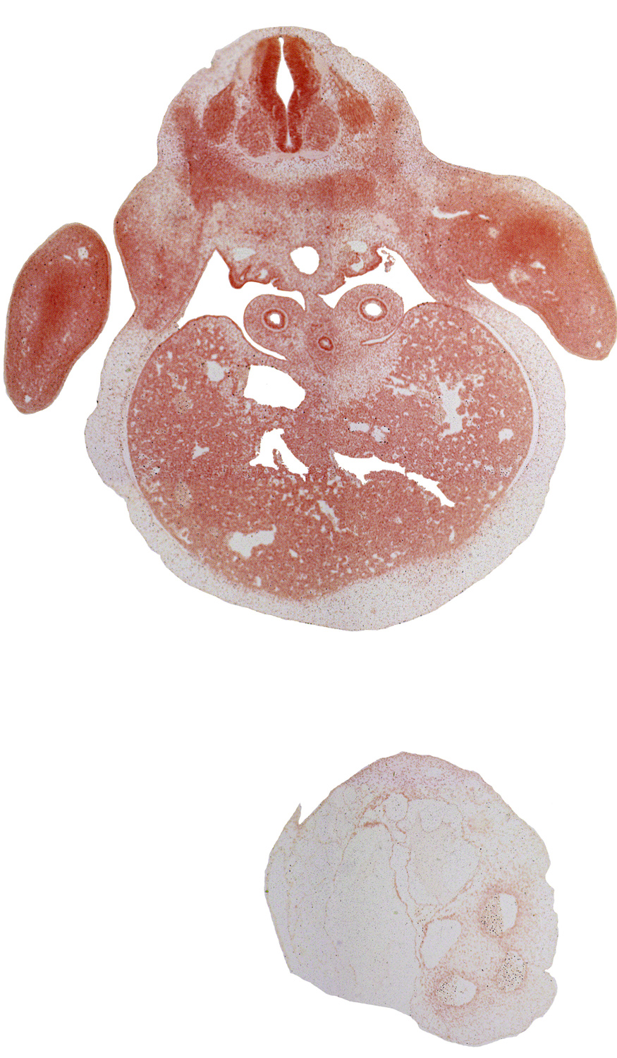 C-8 spinal ganglion, aorta, arm, brachial artery, ductus venosus, esophagus endoderm, hepatic sinusoid, left lobe of liver, liver prominence, lower secondary bronchus bud, mesenchymal condensation around hindgut, mesoderm condensation in hand plate, neural arch, right lobe of liver, sympathetic trunk