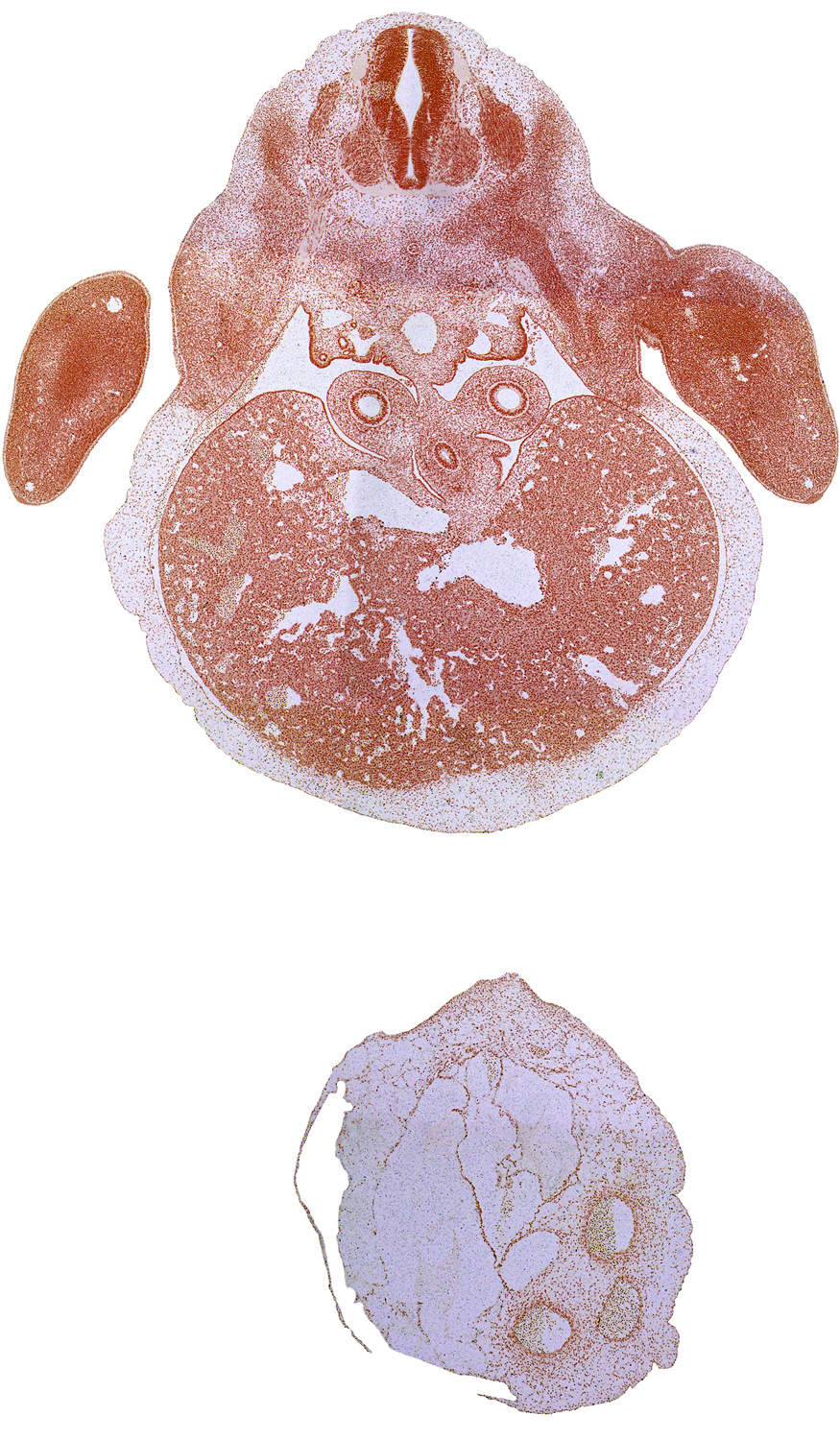 C-8 spinal ganglion, T-1 ventral primary ramus, blastema of rib 1, dorsal meso-esophagus, ductus venosus, efferent hepatic veins, esophagus endoderm, hand plate, hepatic sinusoid, liver prominence, lower secondary bronchus bud, marginal vein, mesonephric duct, notochord, peritoneal cavity, pleuroperitoneal opening, primordial pleural cavity