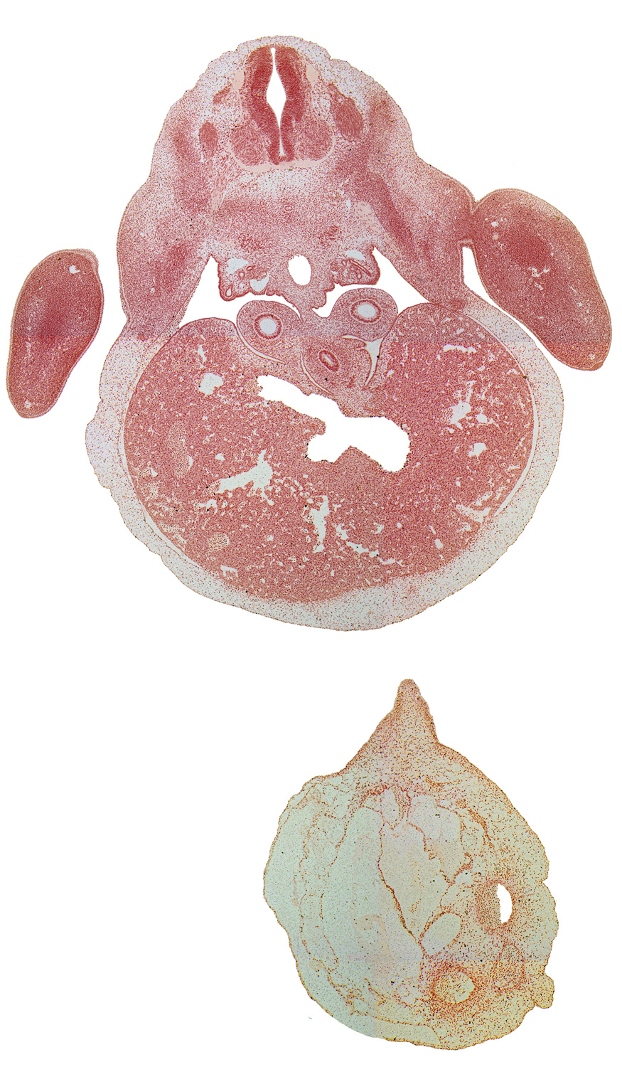 C-8 spinal ganglion, T-1 ventral primary ramus, abdominal wall, aorta, blastema of rib 1, ductus venosus, efferent hepatic veins, forearm, junction of esophagus and stomach, mesonephric duct, mesonephros, pleuroperitoneal opening, thoracic wall