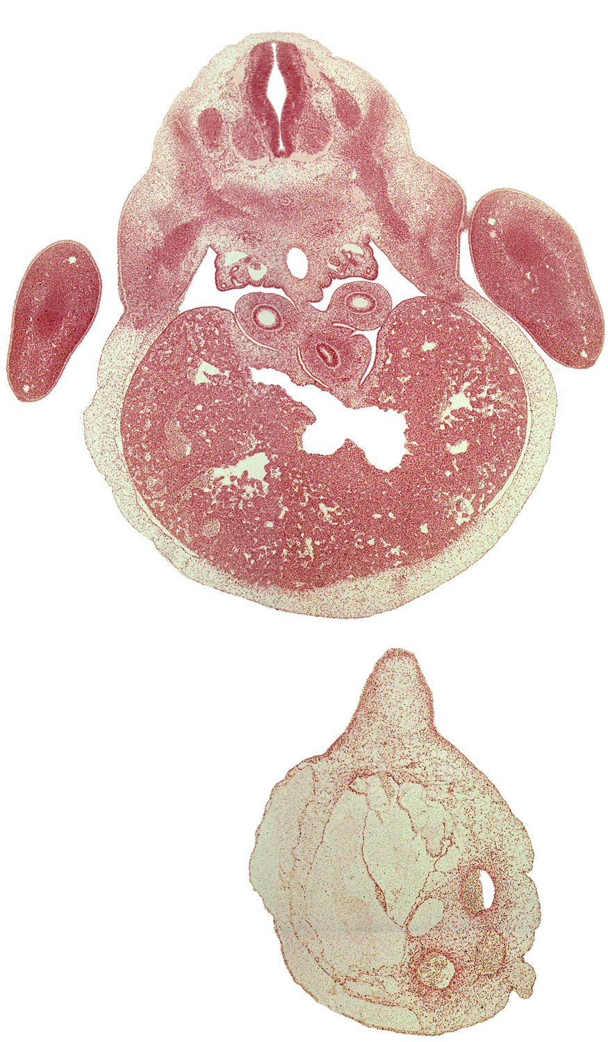 C-8 spinal ganglion, T-1 ventral primary ramus, aorta, blastema of rib 1, ductus venosus, forearm, hand plate, left lobe of liver, mesonephros, notochord, pneumo-enteric recess, postcardinal vein, right lobe of liver, stomach