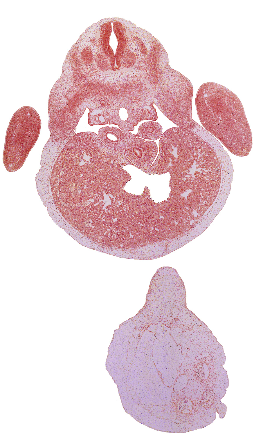 C-8 spinal ganglion, T-1 intercostal nerve, T-1 spinal nerve, dorsal meso-esophagus, ductus venosus, lower secondary bronchus bud, mesonephric capsule, mesonephric duct, neural arch, pneumo-enteric recess, postcardinal vein, stomach endoderm