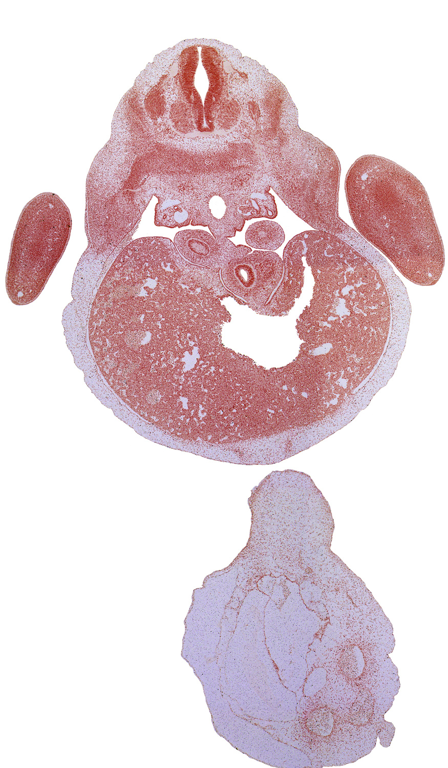 T-1 dorsal primary ramus, T-1 intercostal nerve, T-1 spinal ganglion, T-1 ventral primary ramus, T-1 ventral root, aorta, bare area of liver, dense caudal part of sclerotome, ductus venosus, edge of lower secondary bronchus bud, efferent hepatic veins, hand plate, left lobe of liver, lower secondary bronchus bud, peritoneal cavity, primordial pleural cavity