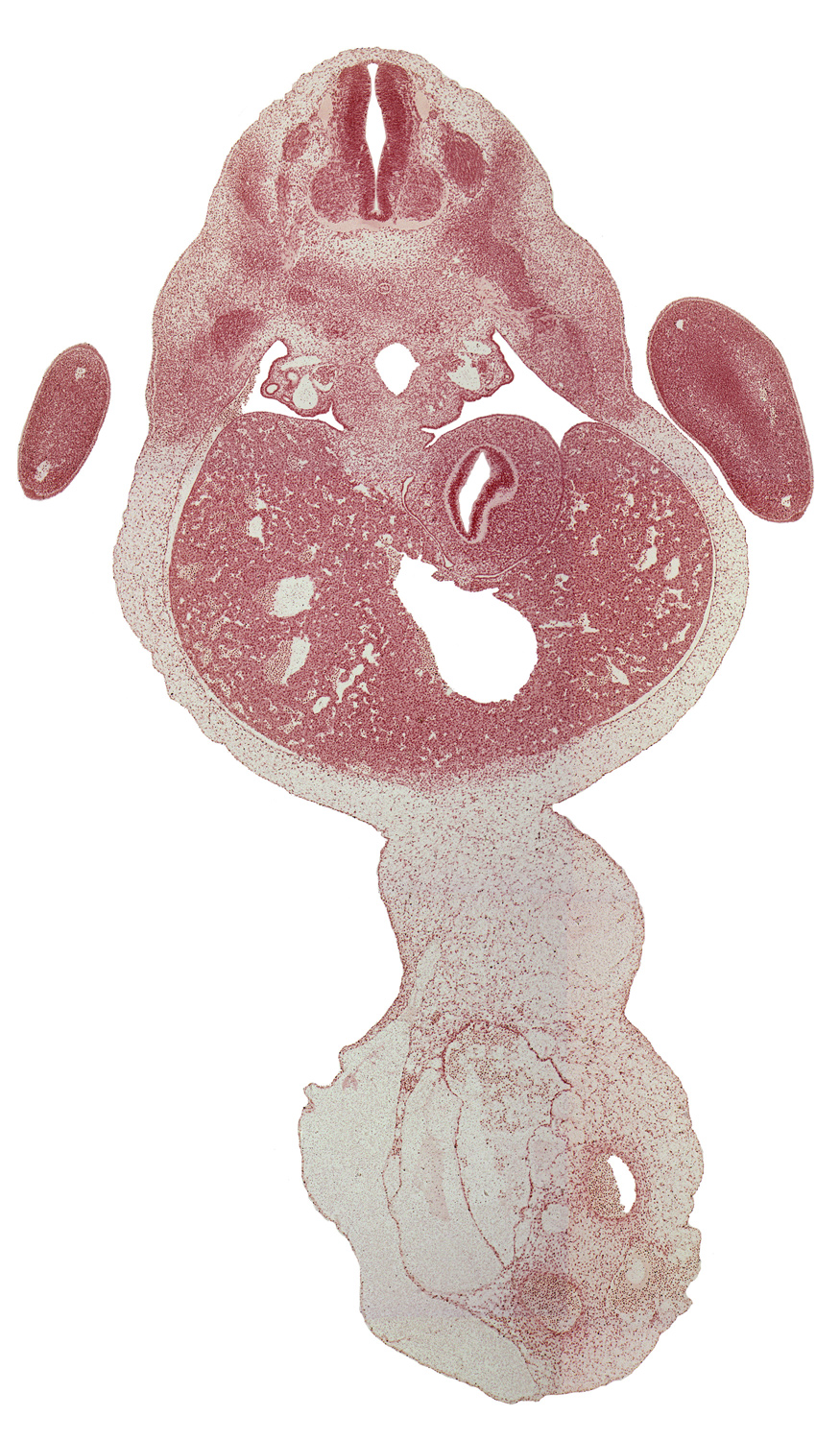 T-1 spinal ganglion, T-2 intercostal nerve, afferent hepatic vein, blastema of rib 2, distal part of hand plate, dorsal mesogastrium, ductus venosus, hand plate, incisure of stomach, intermediate zone, left lobe of liver, marginal zone, mesonephric duct, mesonephric glomerulus, mesonephros, right lobe of liver, umbilical cord, ventricular zone