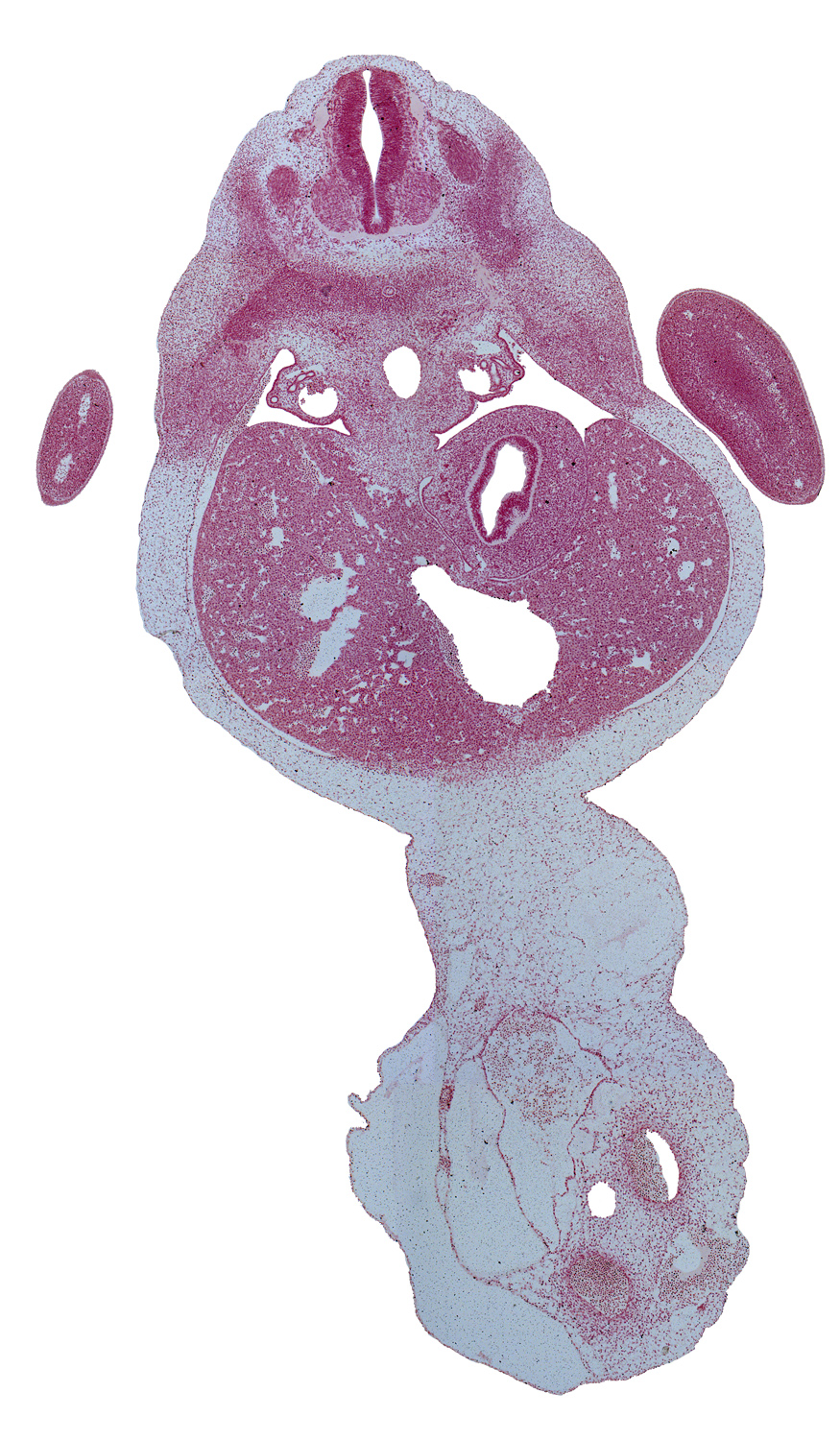 T-1 spinal ganglion, T-2 intercostal nerve, T-2 spinal nerve, afferent hepatic vein, allantois, aorta, blood cells in umbilical coelom, ductus venosus, hand plate, hepatic sinusoid, left umbilical artery, mesonephros, notochord, right umbilical artery, stomach, sympathetic trunk, umbilical vein