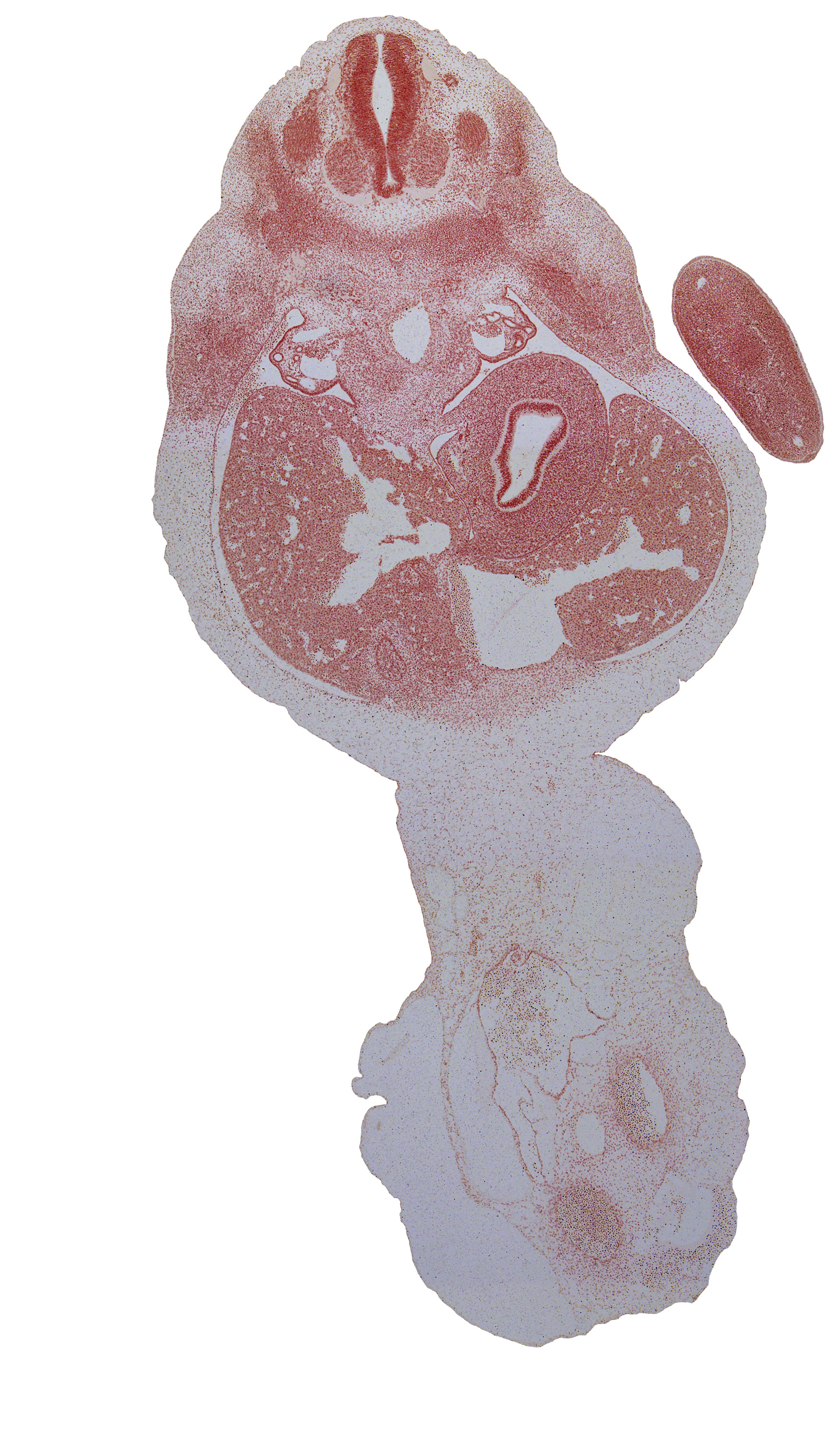 T-1 dorsal root, T-2 spinal ganglion, T-2 spinal nerve, afferent hepatic vein, allantois, amnion, aorta, blastema of rib 3, dorsal mesogastrium, ductus venosus, gall bladder, greater curvature of stomach, left umbilical artery, lesser curvature of stomach, notochord, peritoneal cavity, right lobe of liver, right umbilical artery, suprarenal gland medulla, surface ectoderm, umbilical vein