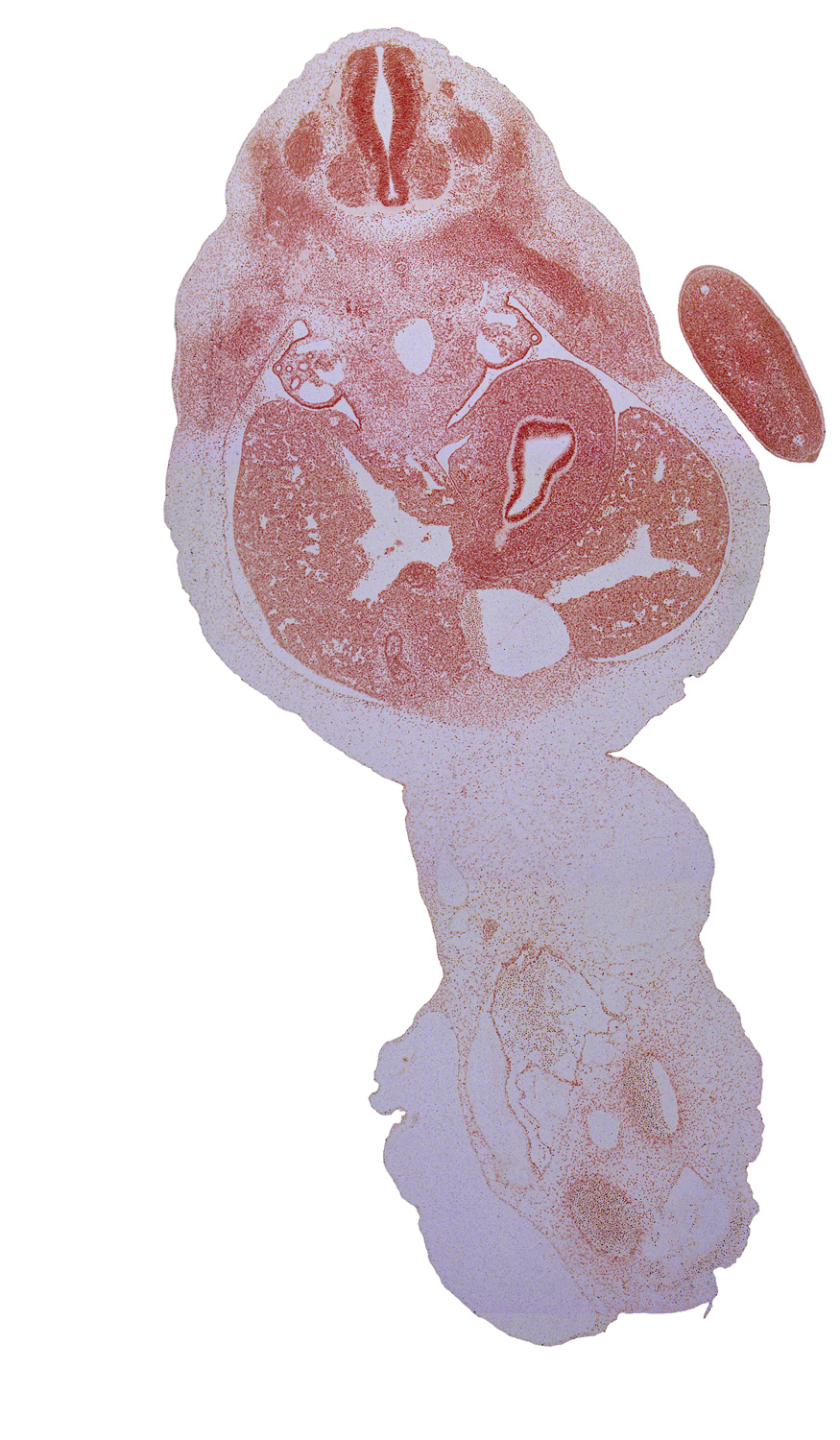 T-1 dorsal root, T-2 spinal ganglion, T-2 ventral root, T-3 intercostal nerve, afferent hepatic vein, aorta, blastema of rib 3, cystic duct, dorsal mesogastrium, ductus venosus, gall bladder, left lobe of liver, mesonephros, right lobe of liver, stomach, sympathetic trunk