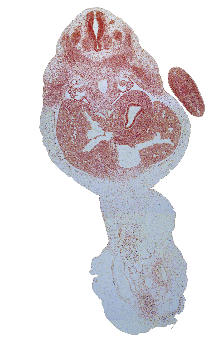 T-1 dorsal root, T-2 spinal ganglion, T-3 intercostal nerve, abdominal wall mesenchyme, allantois, aorta, bare area of liver, blastema of rib 3, blood cells in umbilical coelom, ductus venosus, gall bladder, hand plate, left umbilical artery, presumptive suprarenal gland cortex, right umbilical artery, stomach endoderm, suprarenal gland medulla, sympathetic trunk, umbilical vein