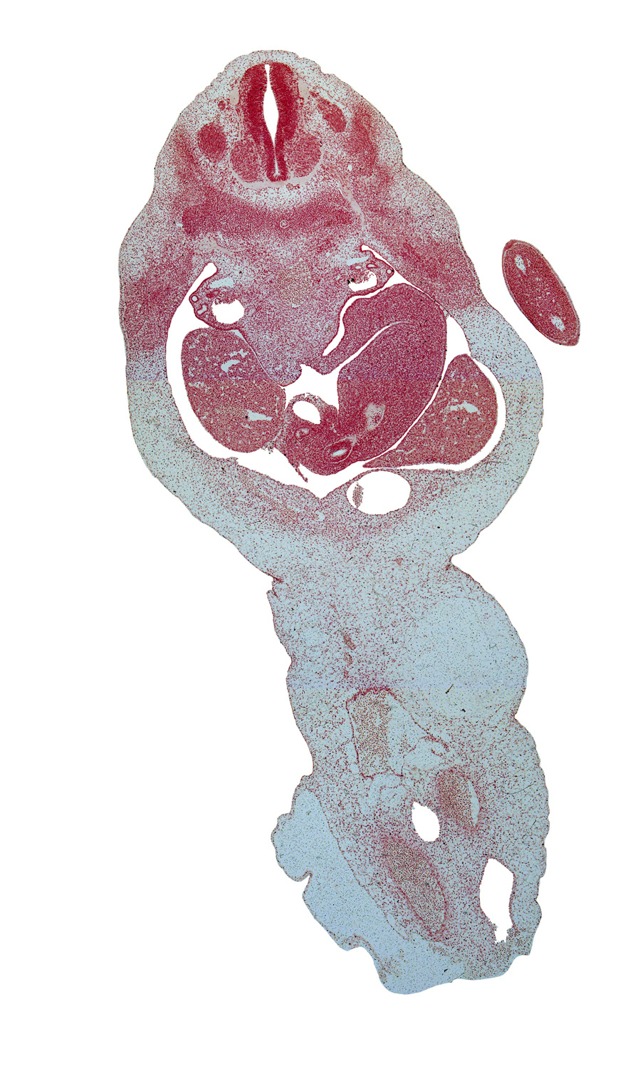 T-2 spinal ganglion, T-3 intercostal nerve, T-3 spinal nerve, dorsal mesogastrium, duodenum, epaxial part of myotome, epiploic foramen, hand plate, left lobe of liver, lesser sac (omental bursa), marginal vein, neural arch, right lobe of liver, spleen, umbilical cord, umbilical vein
