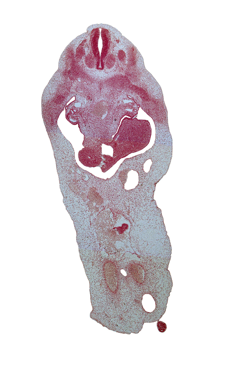 T-4 dorsal and ventral roots, T-4 spinal ganglion, allantois, aorta, blastema of rib 5, celiac artery, duodenum, edge of herniated midgut mesenchyme, left umbilical artery, mammary ridge, mesenchyme in dorsal mesogastrium, neural arch, notochord, right umbilical artery, superior mesenteric vein, umbilical coelom, umbilical vein