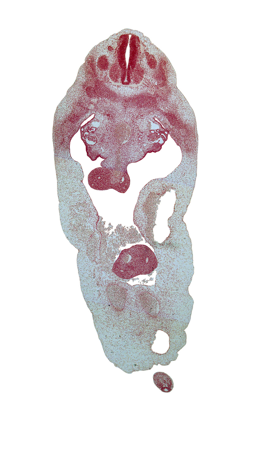 T-4 spinal ganglion, T-5 spinal nerve, aorta, blastema of rib 6, distal limb of herniated midgut, duodenum, gonadal ridge, peritoneal cavity, postcardinal vein, proximal limb of herniated midgut, subcardinal vein, superior mesenteric vein, sympathetic trunk, umbilical coelom, umbilical cord, umbilical vein