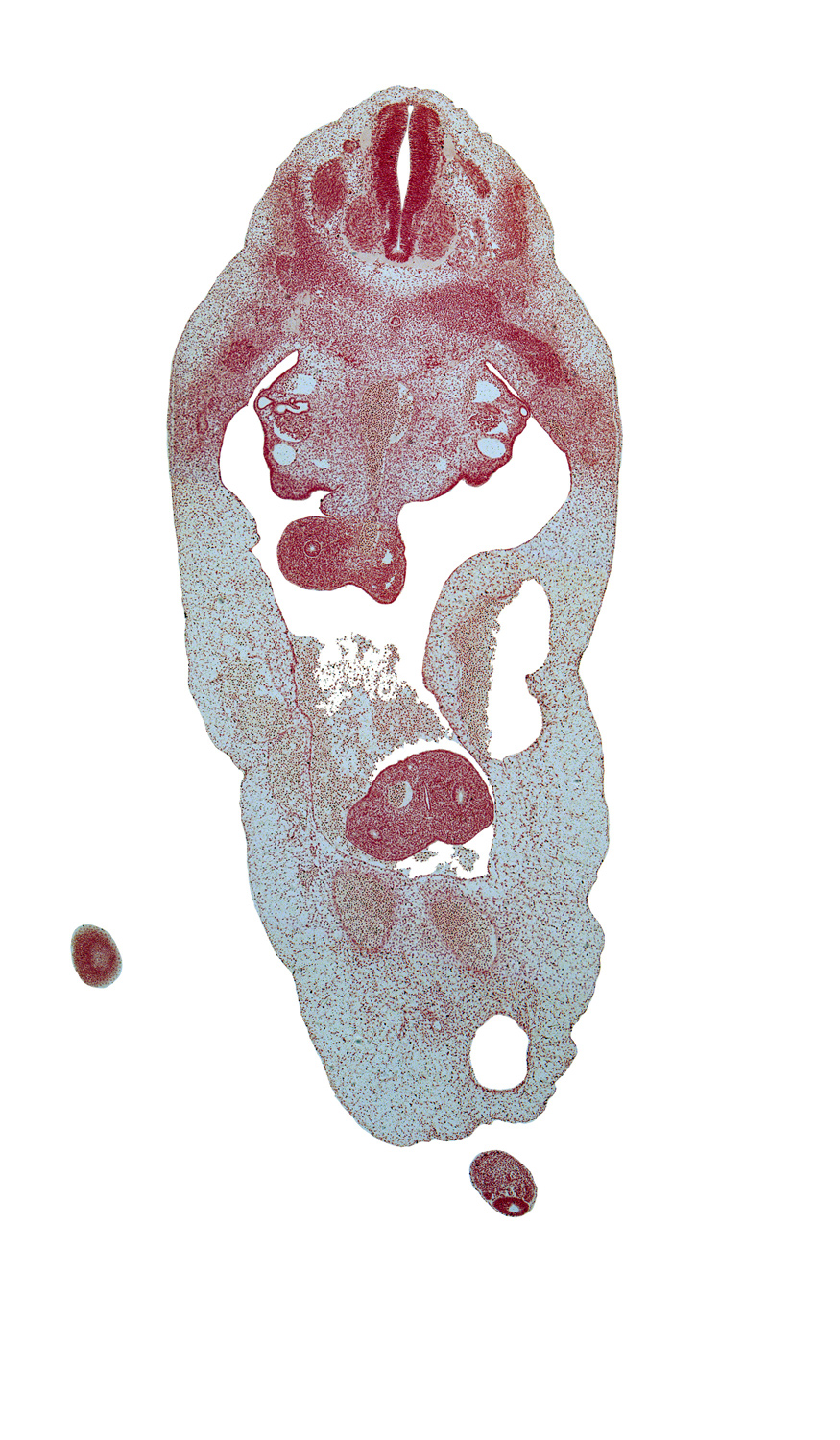 T-4 dorsal root, T-5 ventral root, alar plate(s), basal plate, blastema of rib 6, caudal eminence, cephalic edge of lower limb, distal limb of herniated midgut, dorsal mesentery, duodenum, floor plate, gonadal ridge, postcardinal vein, proximal limb of herniated midgut, roof plate, sulcus limitans, superior mesenteric artery, superior mesenteric vein, umbilical cord