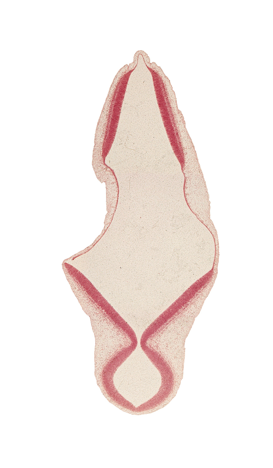 alar plate of myelencephalon, artifact separation(s), edge of isthmus of rhombencephalon, edge of junction of mesencoel and rhombencoel (fourth ventricle), isthmus of rhombencephalon, mesencephalon, mesencoel, rhombencoel (fourth ventricle), roof plate of rhombencephalon