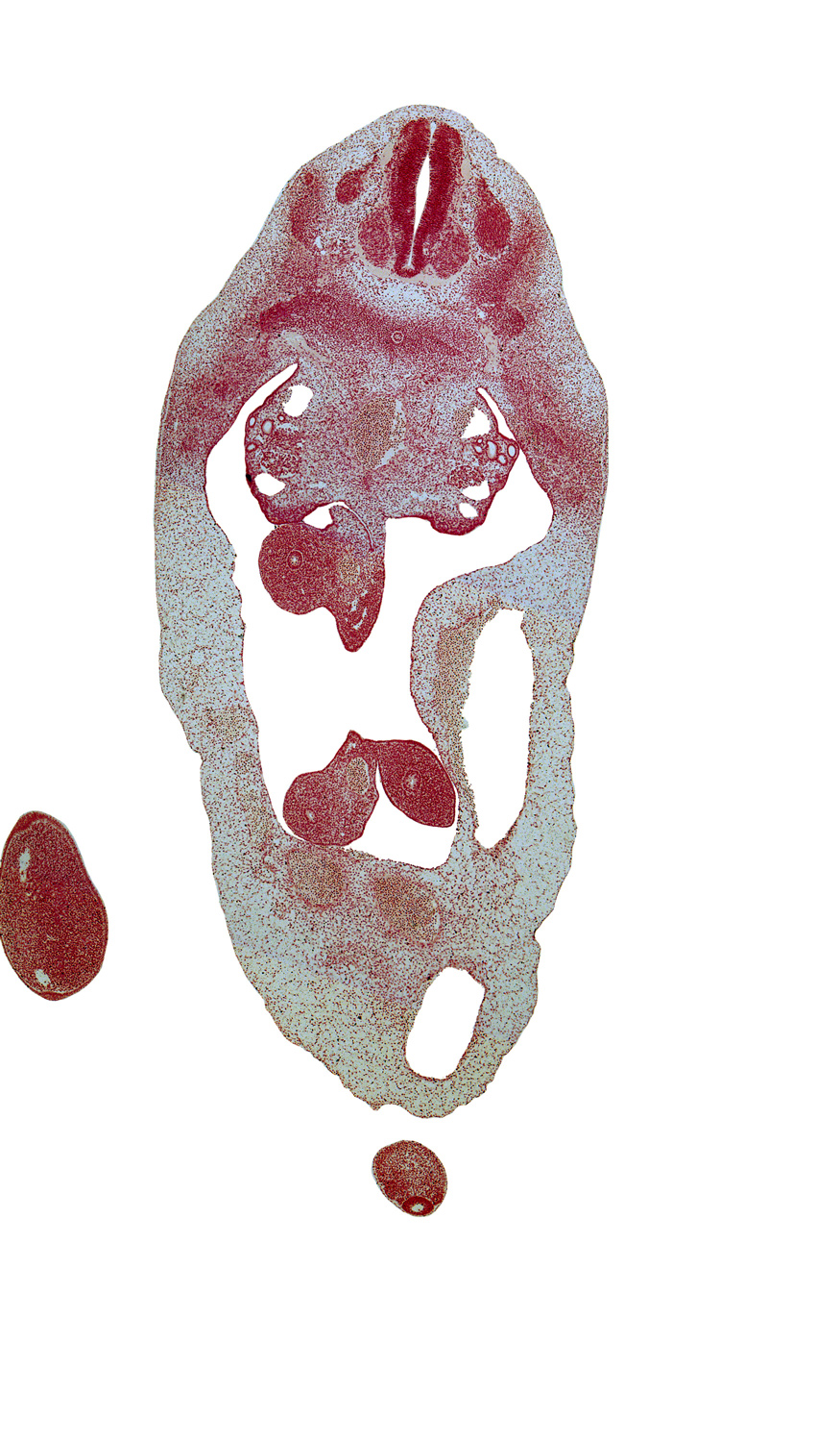 T-5 spinal ganglion, T-6 intercostal nerve, T-6 spinal nerve, blastema of rib 6, distal limb of herniated midgut, duodenum, foot plate, mesenchymal condensation around hindgut, neural arch, postcardinal vein, primordial filum terminale, proximal limb of herniated midgut, superior mesenteric artery, umbilical coelom, umbilical cord