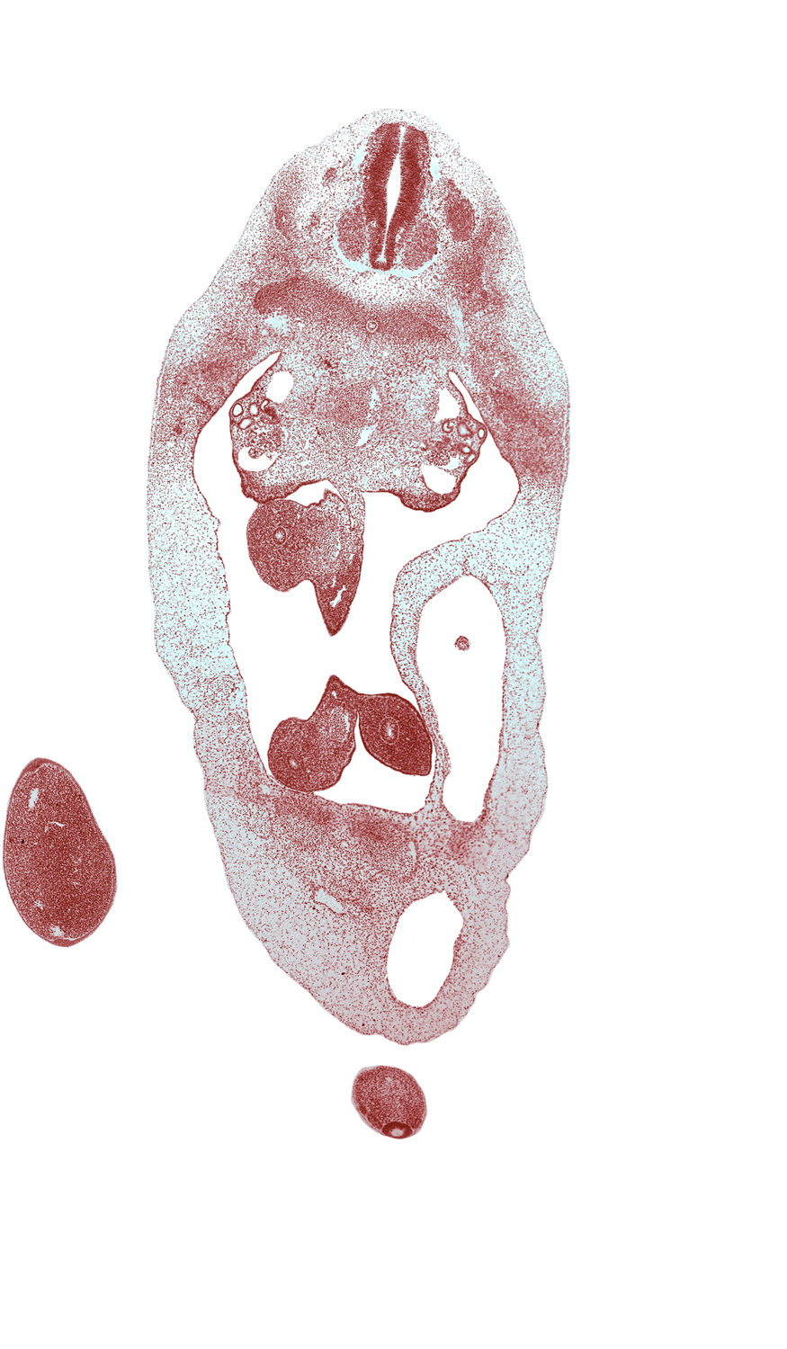 T-5 spinal ganglion, T-6 intercostal nerve, T-6 spinal nerve, aorta, blastema of rib 7, caudal eminence, dorsal mesentery, duodenum, foot plate, gonadal ridge, herniated midgut, mesenchymal condensation around hindgut, mesonephric duct, notochord, peritoneal cavity, umbilical cord