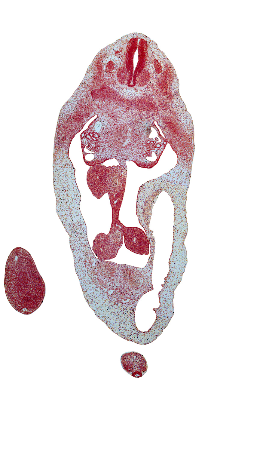 T-6 spinal ganglion, T-6 spinal nerve, aorta, blastema of rib 7, distal limb of herniated midgut, dorsal mesentery, duodenum, gonadal ridge, mesonephric duct, mesonephric tubule(s), proximal limb of herniated midgut, superior mesenteric artery, superior mesenteric vein, umbilical vein