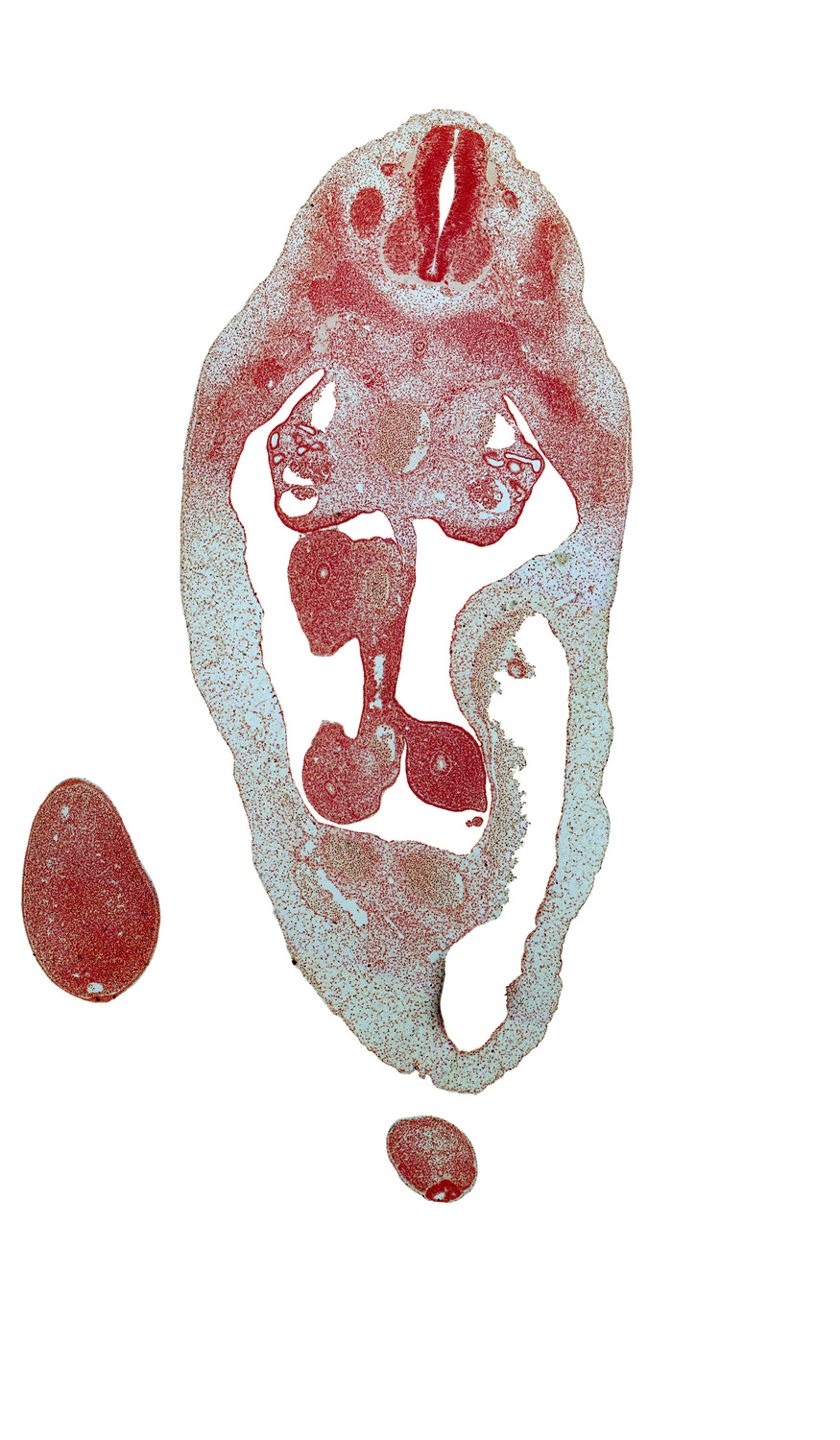 T-5 dorsal root, T-6 spinal nerve, blastema of rib 7, coccygeal mesoderm, distal limb of herniated midgut, dorsal mesentery, duodenum, foot plate, intersubcardinal anastomosis, peritoneal cavity, primordial filum terminale, proximal limb of herniated midgut, superior mesenteric artery, umbilical coelom, umbilical cord