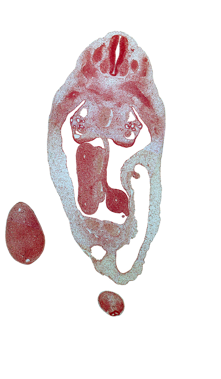 T-6 spinal ganglion, T-7 intercostal nerve, blastema of rib 7, distal limb of herniated midgut, dorsal mesentery of midgut, leg, mesonephric capsule, notochord, peritoneal cavity, primordial filum terminale, proximal limb of herniated midgut, umbilical coelom, umbilical vein