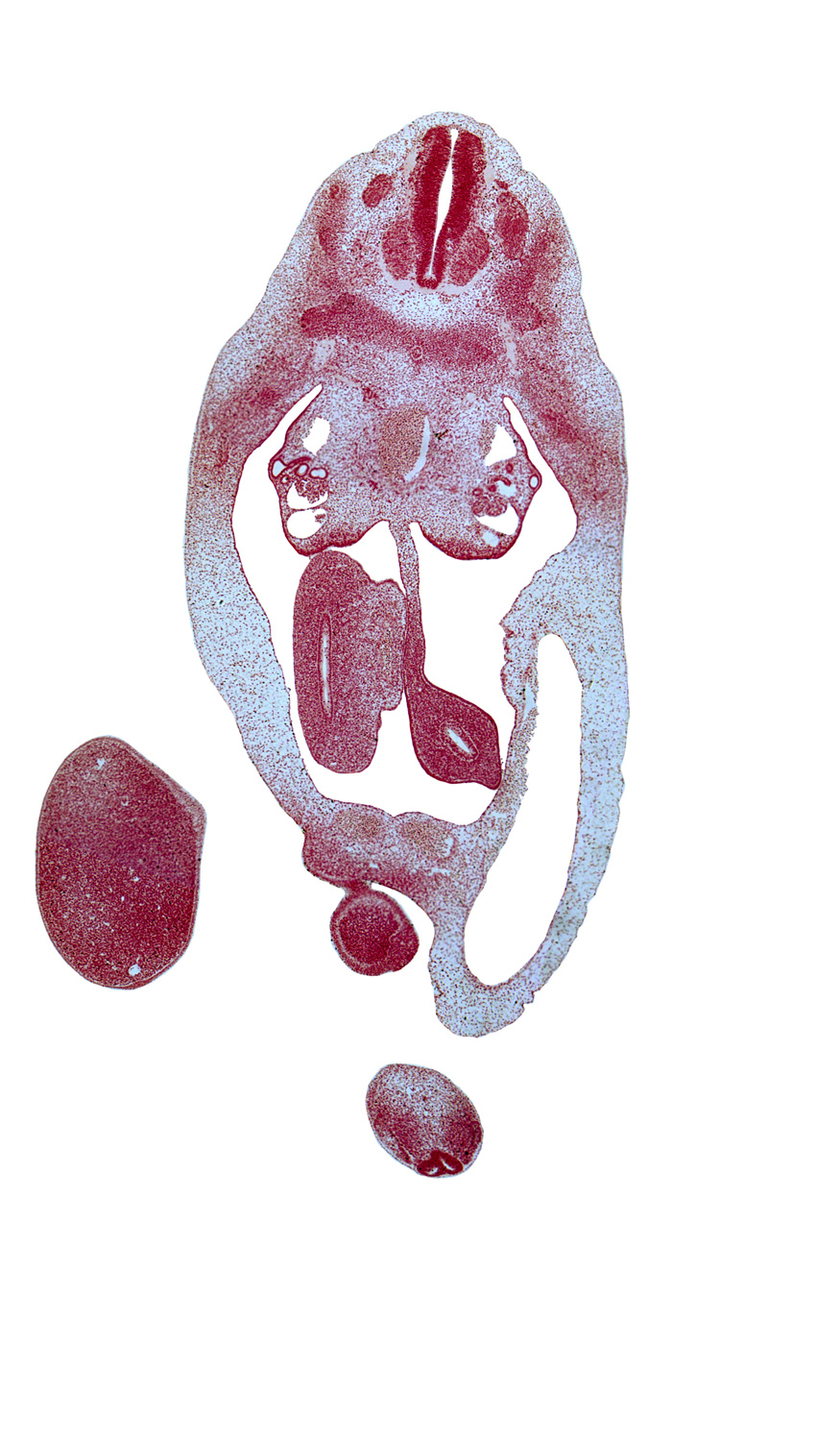 T-6 spinal ganglion, T-7 spinal nerve, blastema of rib 8, caudal eminence, cecum of midgut, edge of proximal limb of herniated midgut, genital tubercle, labioscrotal swelling, lateral coelomic bay, leg, medial coelomic bay, myotome, peritoneal cavity, postcardinal vein, umbilical coelom, umbilical cord