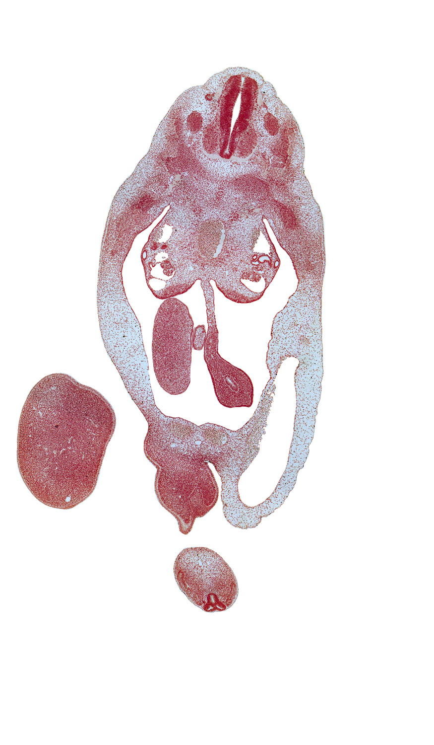 T-6 spinal ganglion, T-7 spinal nerve, allantois, anal pit, blastema of rib 8, cecum, dorsal mesentery, labioscrotal swelling, left umbilical artery, mesonephric capsule, mesonephric duct, midgut mesenchymal condensation, postcardinal vein, primordial filum terminale in three parts, right umbilical artery, sympathetic trunk, umbilical vein