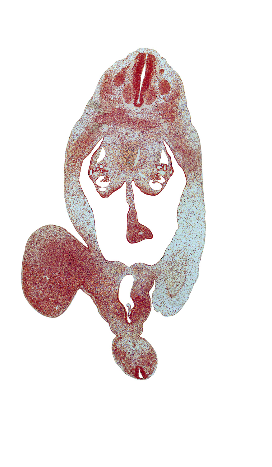 T-7 spinal ganglion, T-8 spinal nerve, abdominal wall mesenchyme, dorsal mesentery, hindgut, labioscrotal swelling, mesonephric duct, mesonephric glomerulus, notochord, postcardinal vein, rectal part of cloaca, skeletal blastema of femur, urogenital sinus part of cloaca