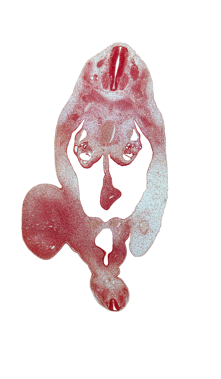 T-7 spinal ganglion, T-8 dorsal primary ramus, T-8 spinal nerve, aorta, blastema of rib 9, central canal, dorsal mesentery, edge of umbilical vein, hindgut endoderm, junction of rectum and urogenital sinus, left umbilical artery, mesonephric duct, neural arch, pelvic part of peritoneal cavity, rectum, right umbilical artery, sympathetic trunk, thigh, urogenital sinus, urorectal septum