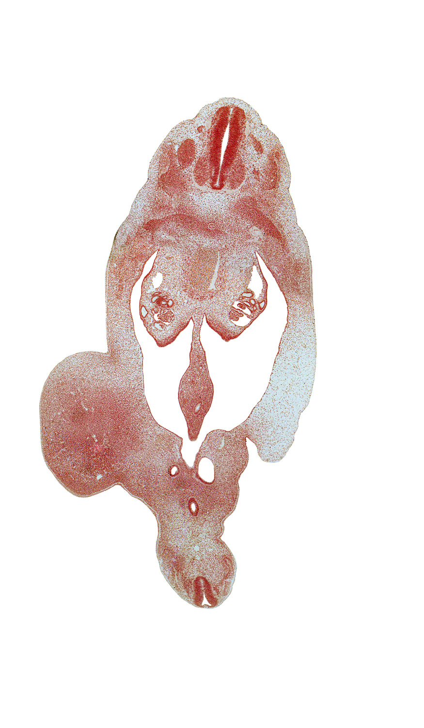 T-7 spinal ganglion, T-8 spinal ganglion, T-8 ventral root, abdominal wall, aorta, blastema of rib 9, central canal, hindgut, horn of urogenital sinus, mesonephric duct, mesonephric tubule(s), peritoneal cavity, postcardinal vein, rectum, thigh