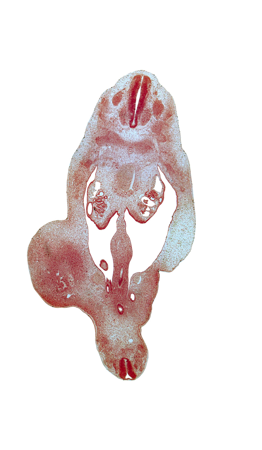 Co-1 spinal ganglion, T-8 spinal ganglion, T-9 spinal nerve, abdominal wall mesenchyme, alar plate(s), basal plate, blastema of rib 10, caudal end of gonadal ridge, gonadal ridge, hindgut, horn of urogenital sinus, left umbilical artery, mesonephric artery, peritoneal cavity, rectum, right umbilical artery, spinal cord, sulcus limitans