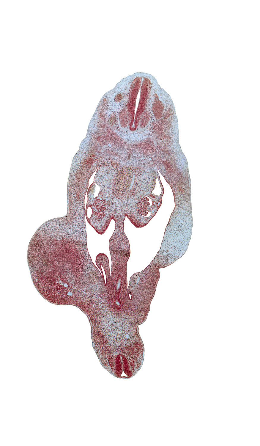 Co-1 spinal ganglion, T-10 intercostal nerve, T-8 spinal ganglion, T-9 dorsal primary ramus, T-9 spinal nerve, blastema of rib 10, central canal, dorsal mesentery, floor plate, gonadal ridge, hindgut, junction of hindgut and rectum, mesonephric duct, mesonephric duct near junction with urogenital sinus, metanephric diverticulum, rectum, roof plate