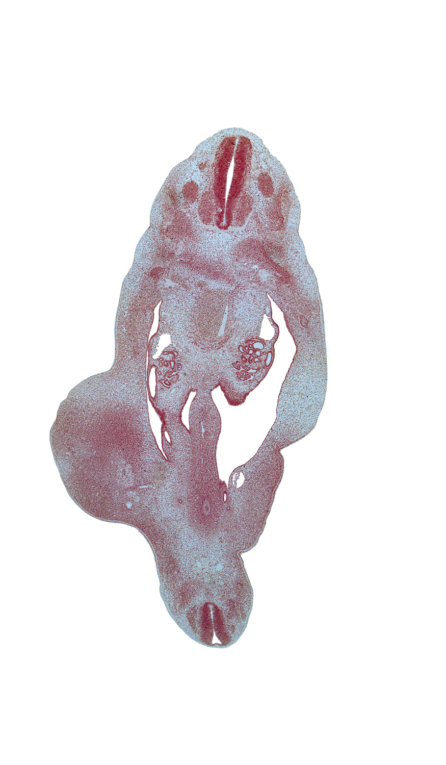 S-5 / Co-1 interganglion region, T-8 spinal ganglion, T-9 ventral root, blastema of rib 10, continuity of caudal and cephalic parts of gonadal ridge, dermatome, dorsal mesentery mesoderm, gonadal ridge, loose cephalic part of sclerotome, mesonephric duct, metanephric diverticulum, myotome, skeletal blastema of femur