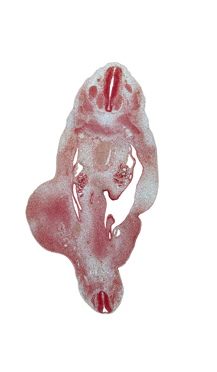 S-5 spinal ganglion, T-10 intercostal nerve, T-8 spinal ganglion, aorta, blastema of rib 10, caudal end of gonadal ridge, dense caudal part of sclerotome, edge of peritoneal cavity, gonadal ridge, mesonephric duct, metanephric diverticulum, peritoneal cavity, postcardinal vein, sympathetic neuroblasts