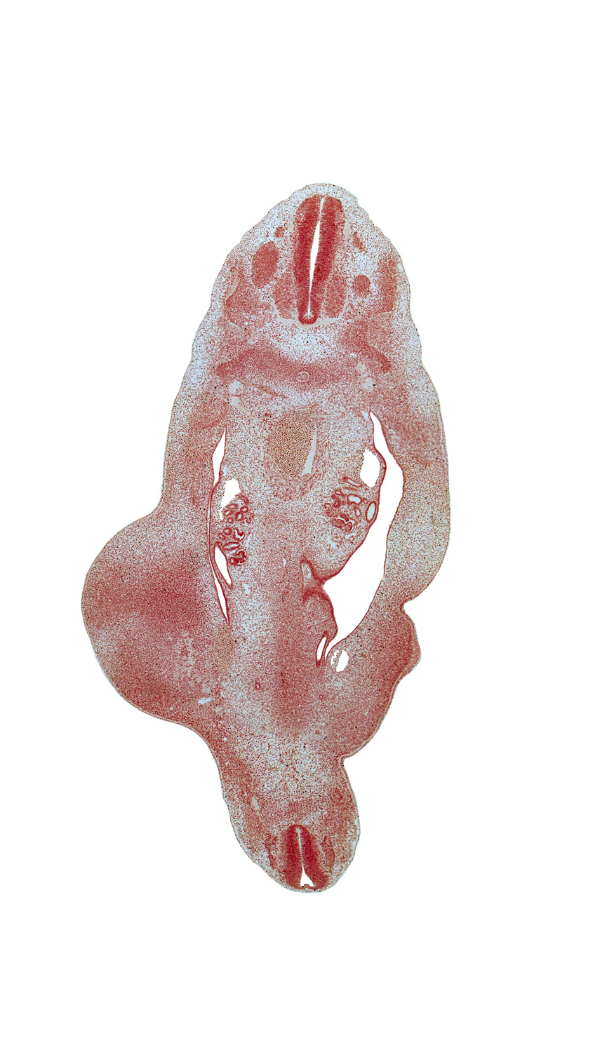 S-5 spinal ganglion, T-8 spinal ganglion, T-9 spinal ganglion, aorta, blastema of rib 10, continuity of caudal and cephalic parts of gonadal ridge, edge of medial thigh, floor plate, mesonephric duct, metanephric diverticulum, notochord, peritoneal cavity, roof plate, sulcus limitans, thigh