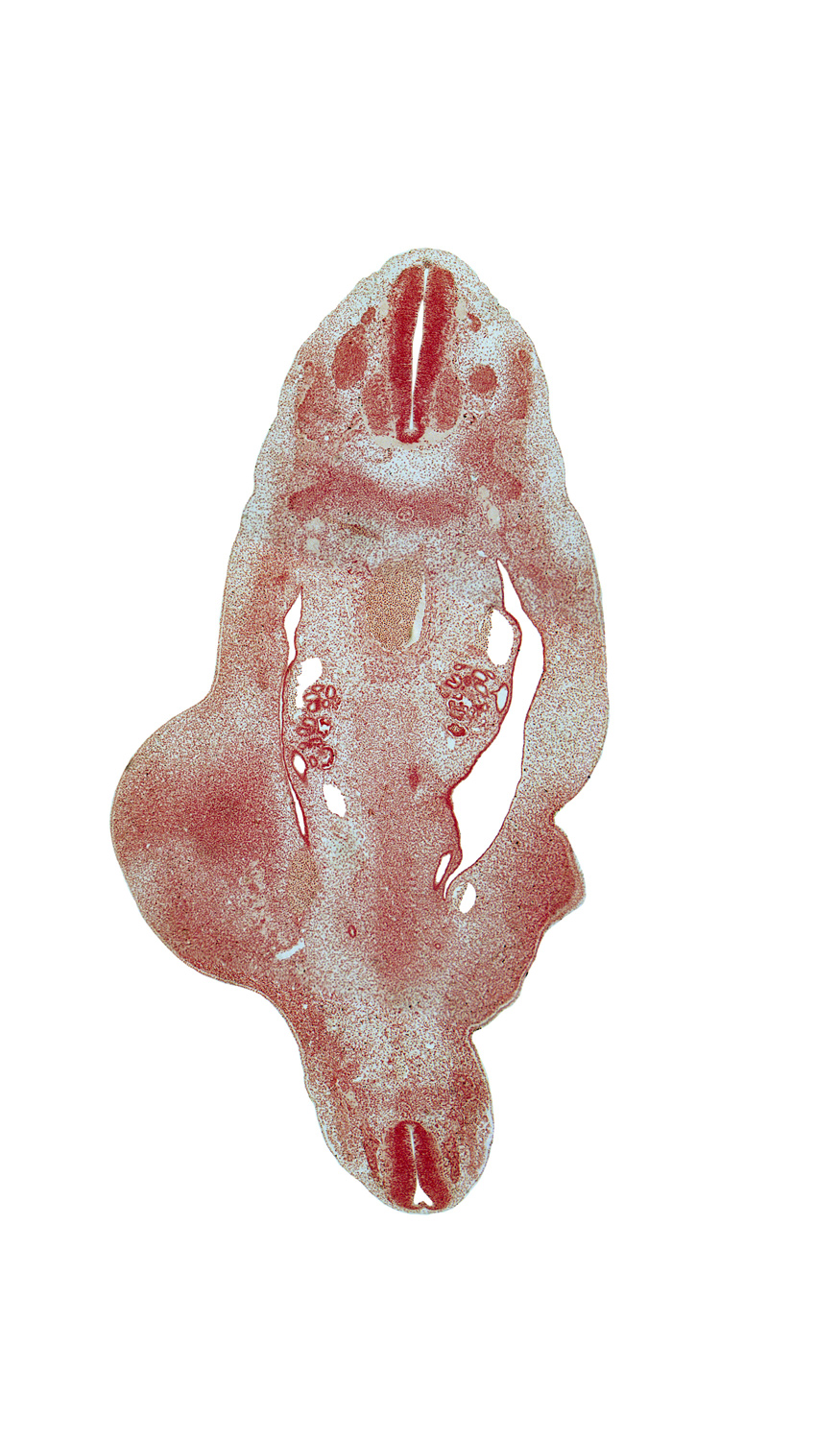 S-5 spinal ganglion, T-10 spinal nerve, T-8 dorsal root, T-9 spinal ganglion, blastema of rib 10, central canal, edge of mesonephric duct, medial thigh, mesonephric duct, metanephric diverticulum, peritoneal cavity, skeletal blastema of femur