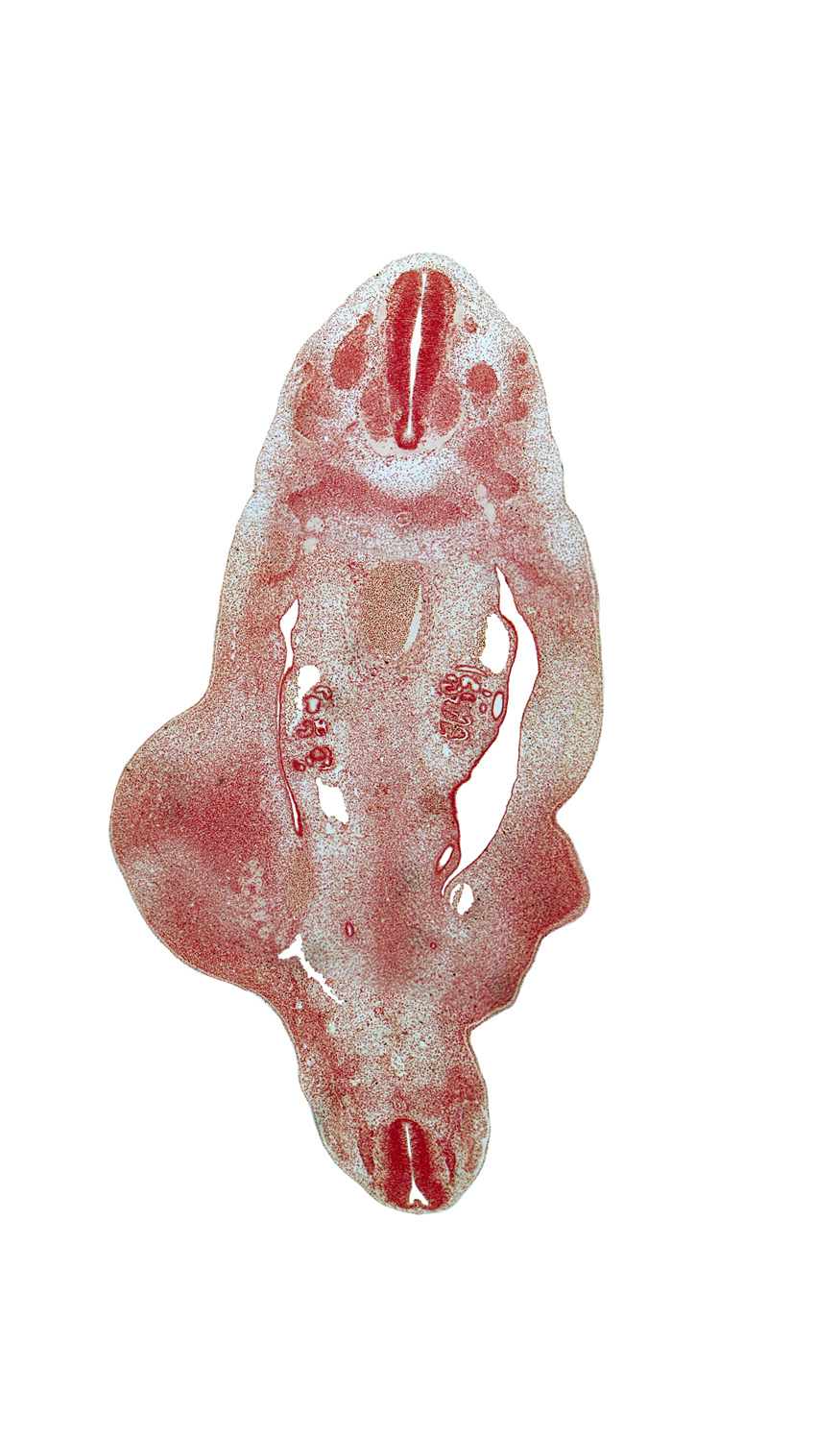 S-5 spinal ganglion, T-10 spinal nerve, T-8 dorsal root, T-9 spinal ganglion, aorta, blastema of rib 10, mesonephric duct, mesonephric vesicle(s), metanephric diverticulum, notochord, postcardinal vein, sympathetic neuroblasts